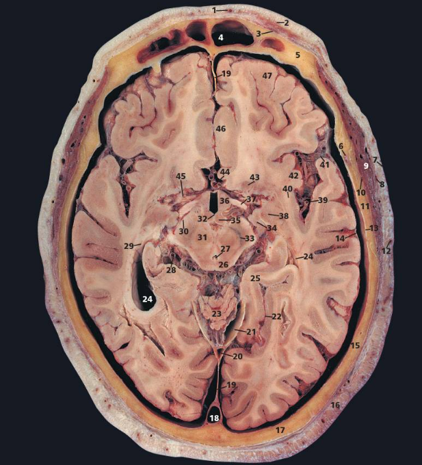 Axial cross-section of the brain
