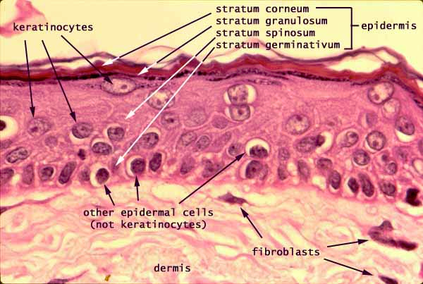 Labeled histology of the epidermis and dermis