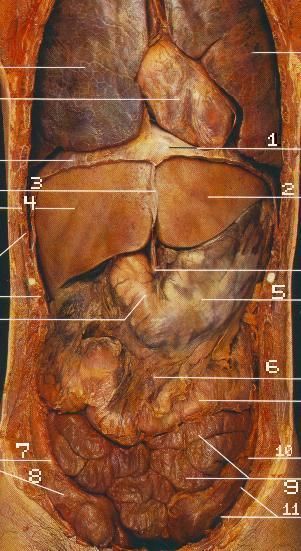 Cadaver abdomen (anterior view): diaphragm, liver lobes with falciform ligament, stomach, greater omentum draping the small bowel, and the frame of ascending/descending/sigmoid colon.
