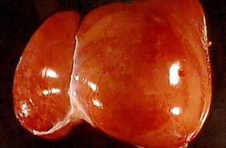 Liver, serosal (visceral) surface showing lobes and peritoneal ligaments.