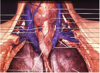 Thyroid follicles filled with colloid, lined by cuboidal follicular cells; parafollicular C cells between follicles.