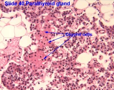 Pancreatic islet (endocrine) surrounded by exocrine acini; α, β, δ, and F cells.
