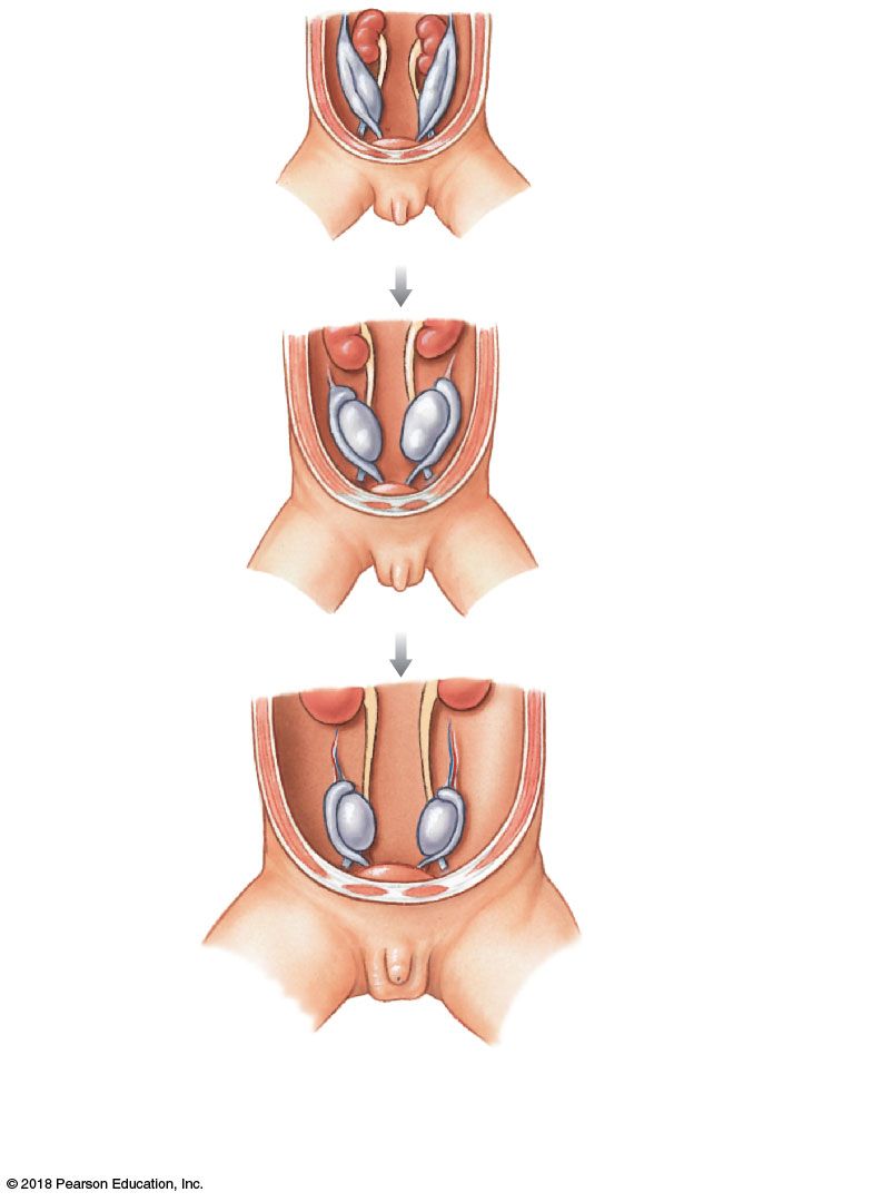 Descent of the testes from the posterior abdomen through the inguinal canal into the scrotum, guided by the gubernaculum.