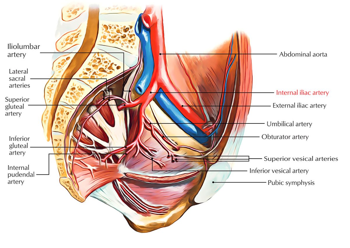 Course of the ureters and the constriction zones where stones commonly lodge.
