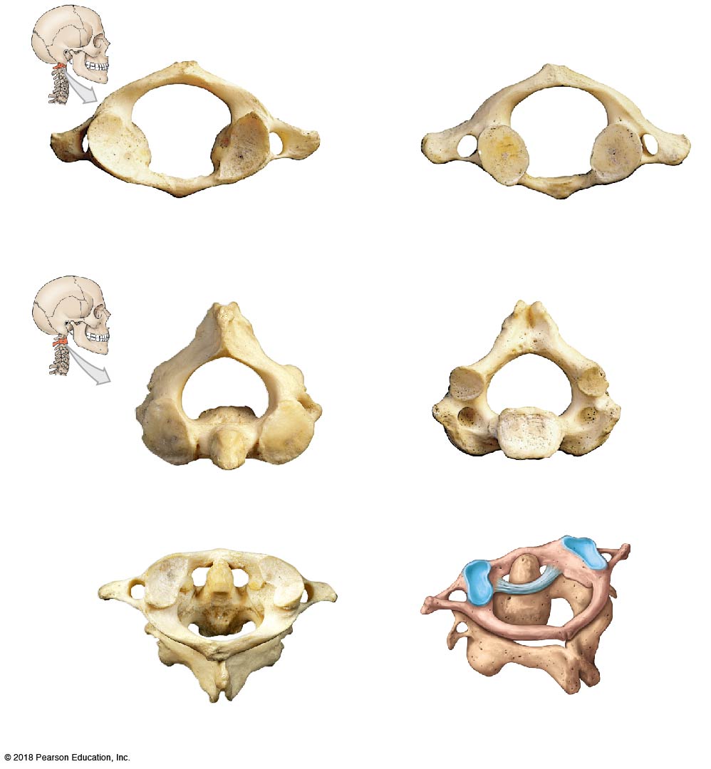 The atlas (C1) and axis (C2) vertebrae