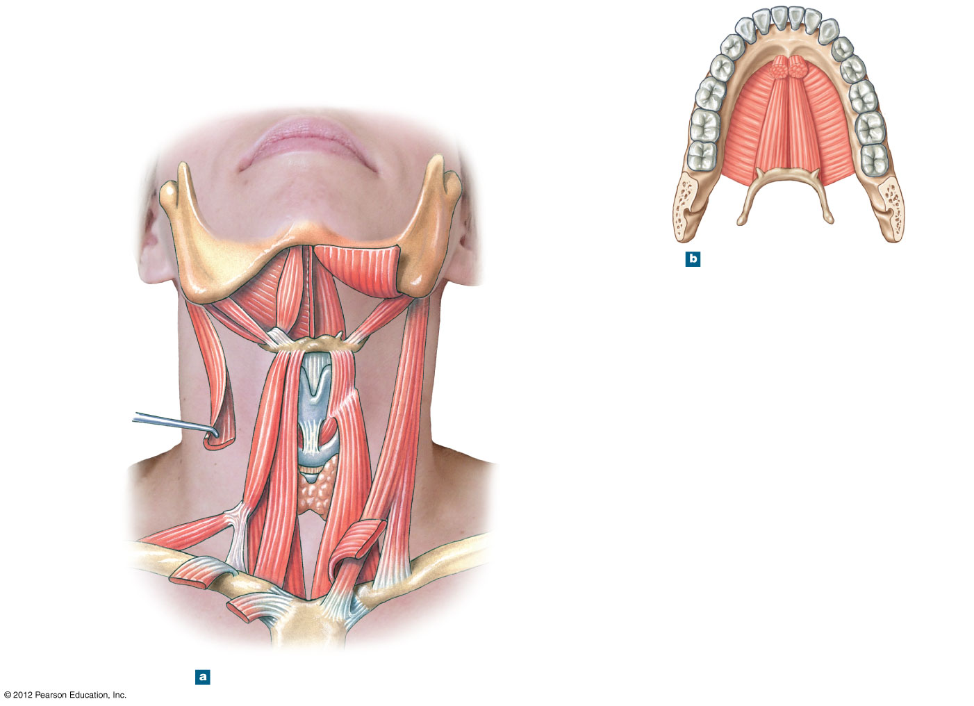 Anterior view of the suprahyoid and infrahyoid neck muscles
