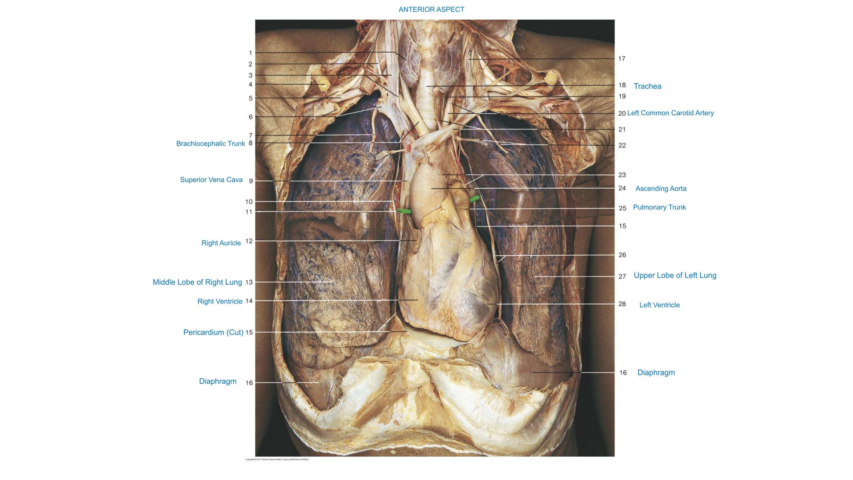 Great Vessels of the Heart (Anterior Aspect), fully labeled