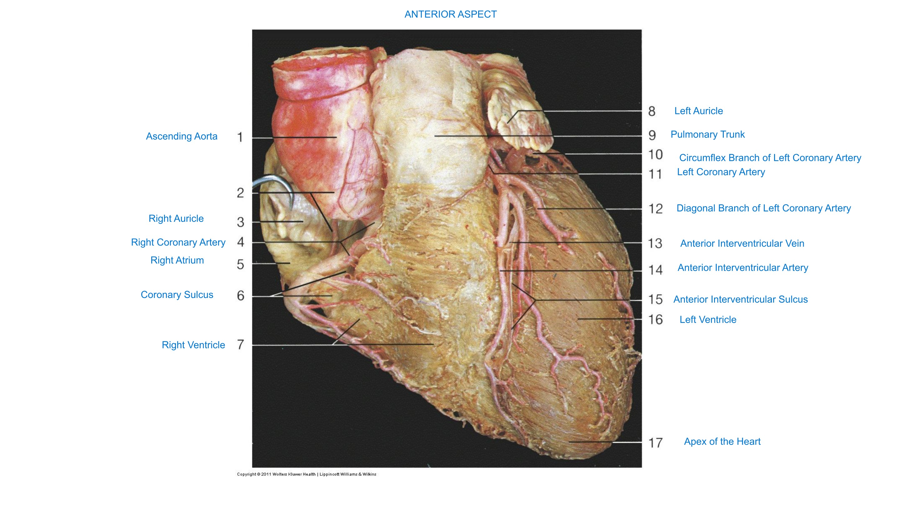 Heart, Coronary Vessels (Anterior Aspect), fully labeled