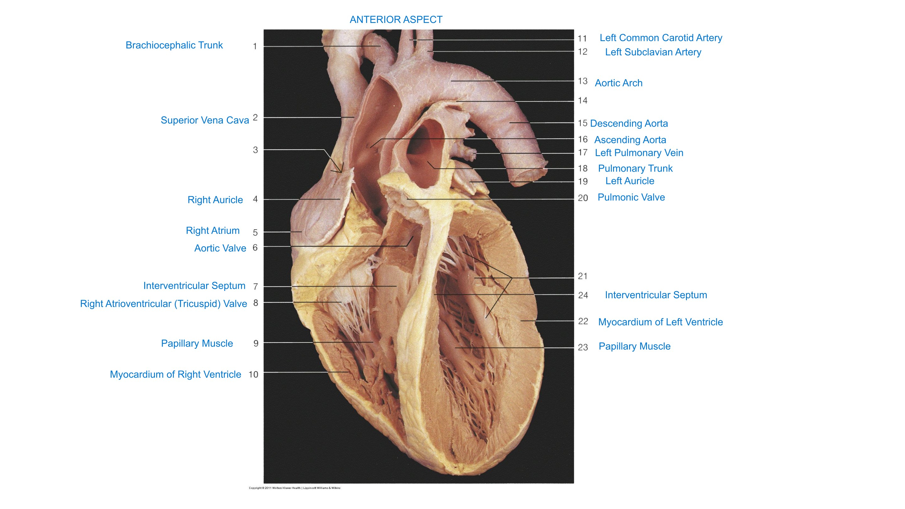 Heart, Interior (Anterior Aspect), fully labeled