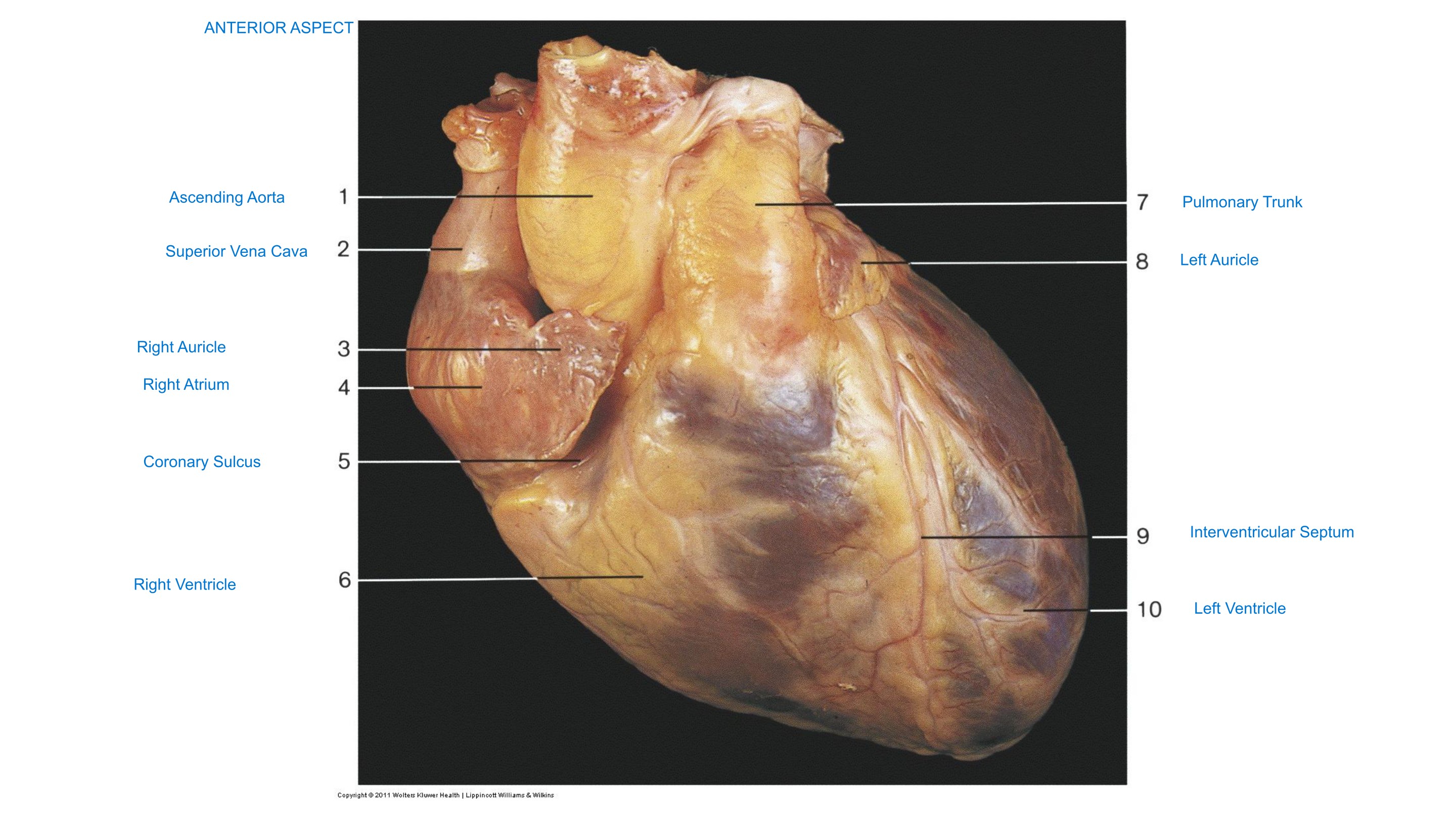 Heart, Isolated (Anterior Aspect), fully labeled