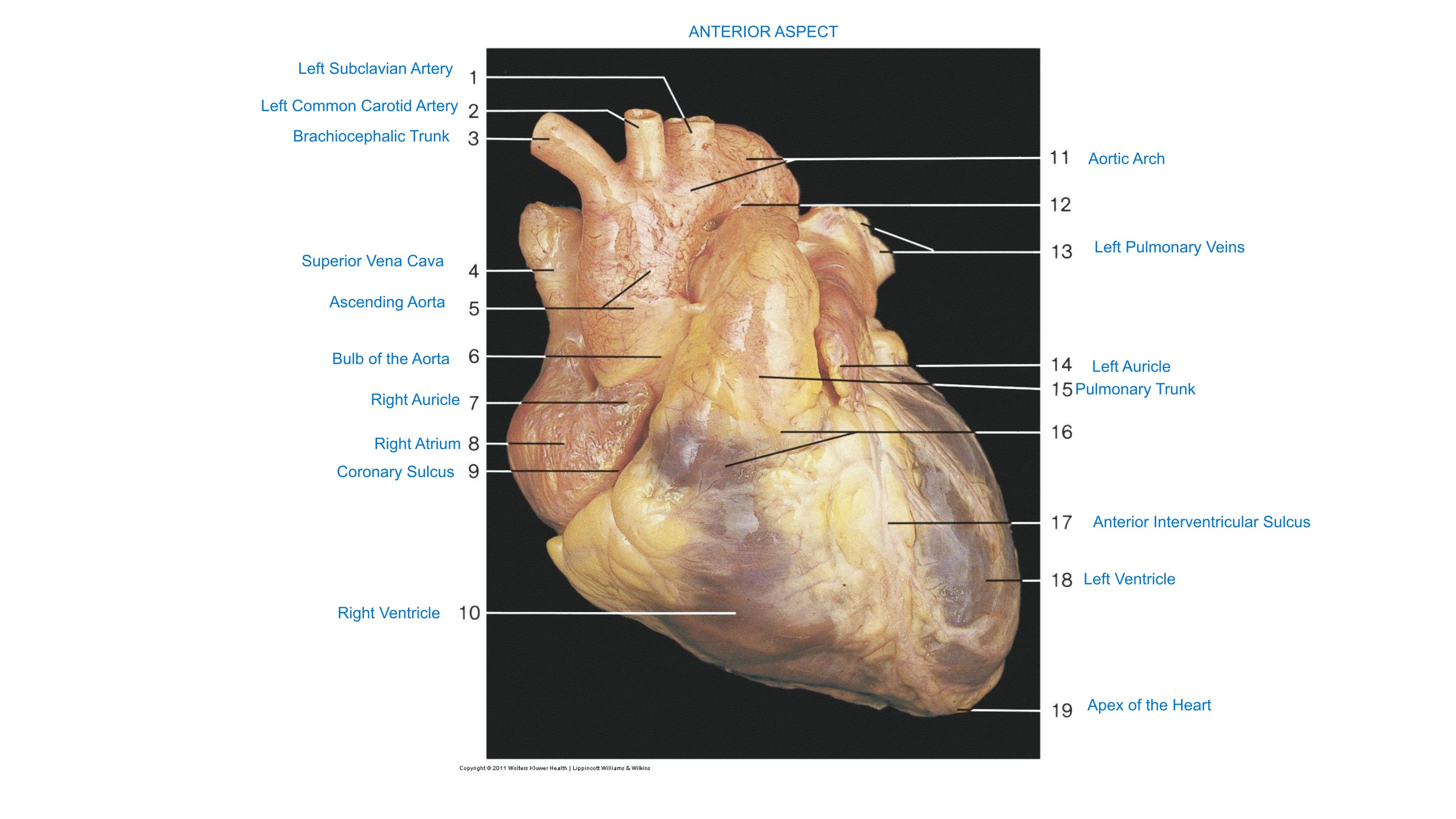 Heart, Isolated (Anterior Aspect), fully labeled
