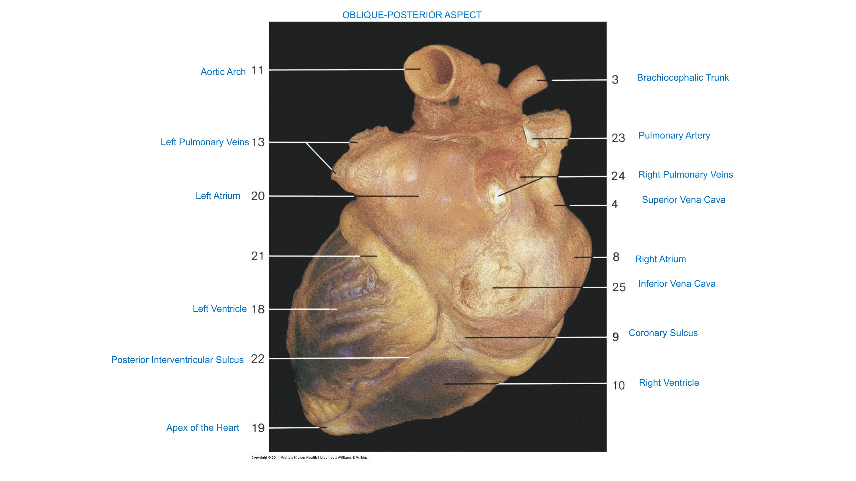 Heart, Isolated (Oblique-Posterior Aspect), fully labeled