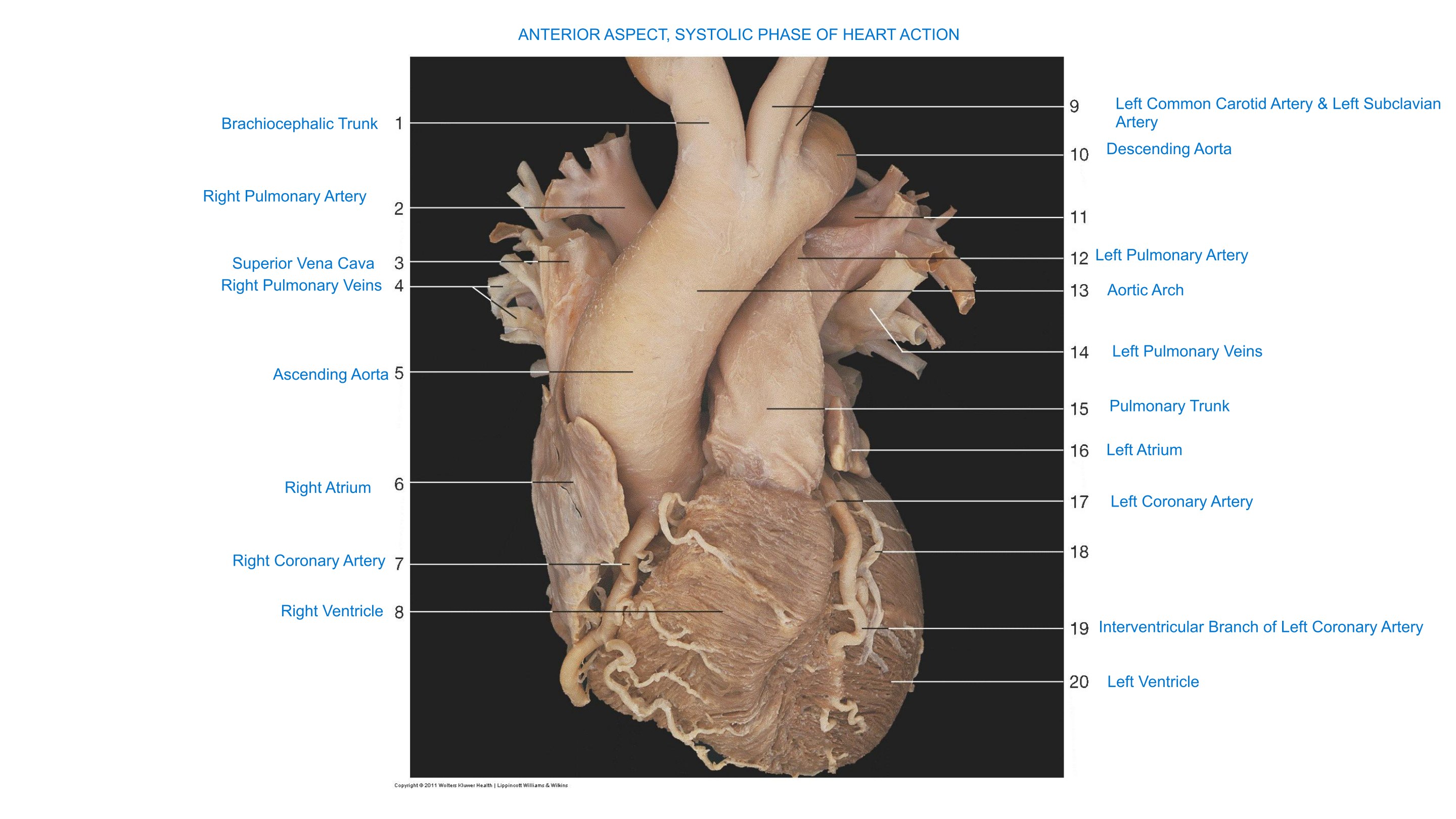 Heart in Systole (Anterior Aspect), fully labeled
