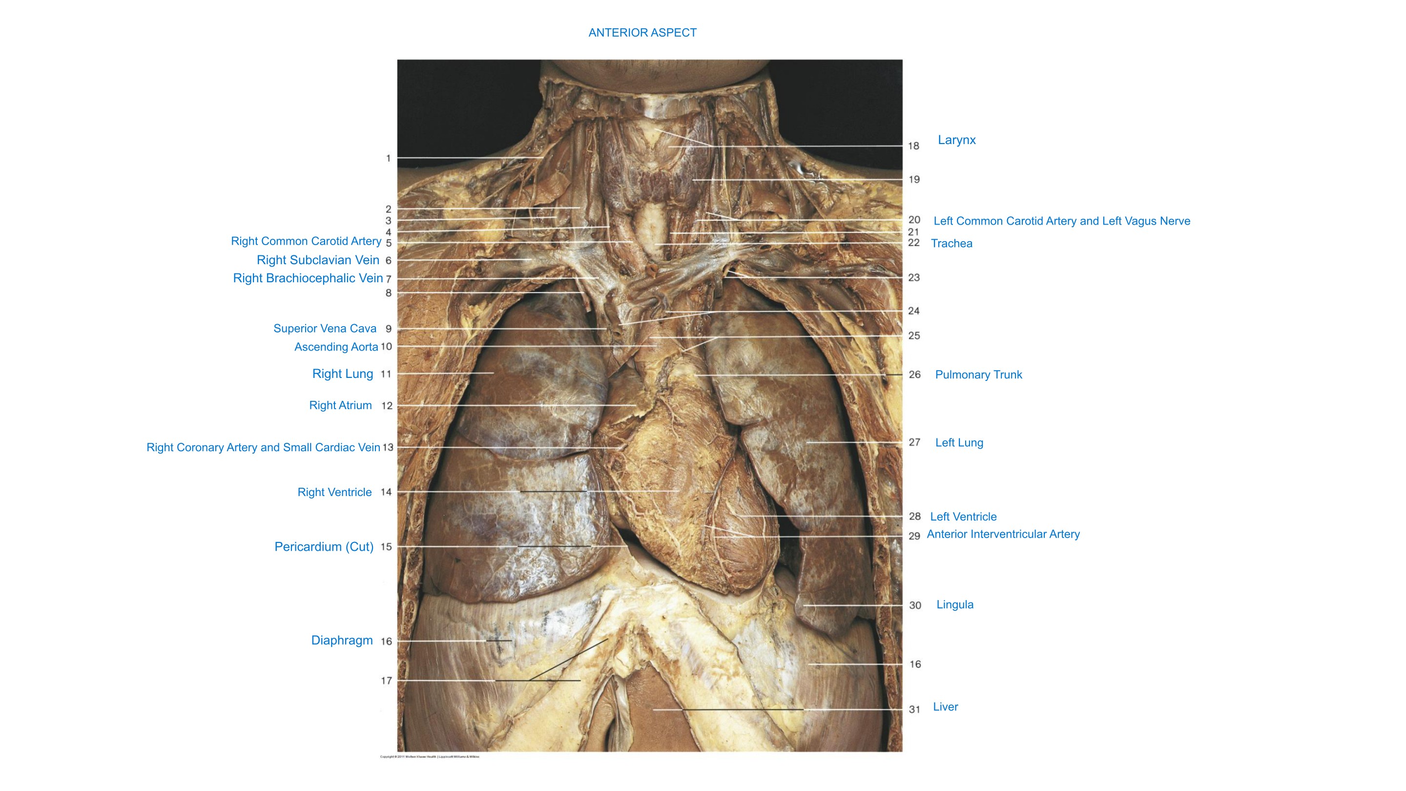 Heart & Great Vessels (Anterior Aspect), fully labeled