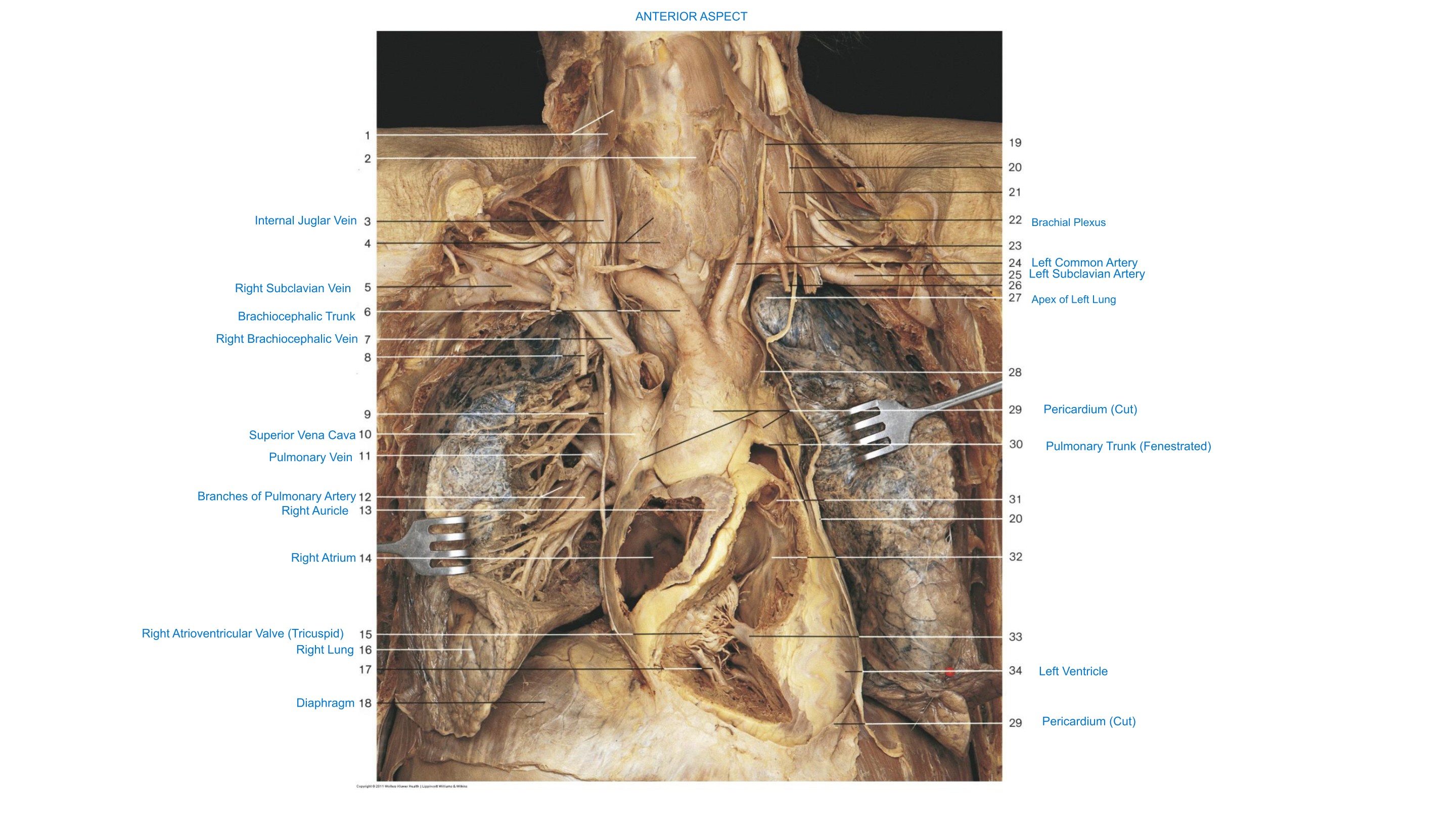 Neck, Heart & Lungs (Anterior Aspect), fully labeled