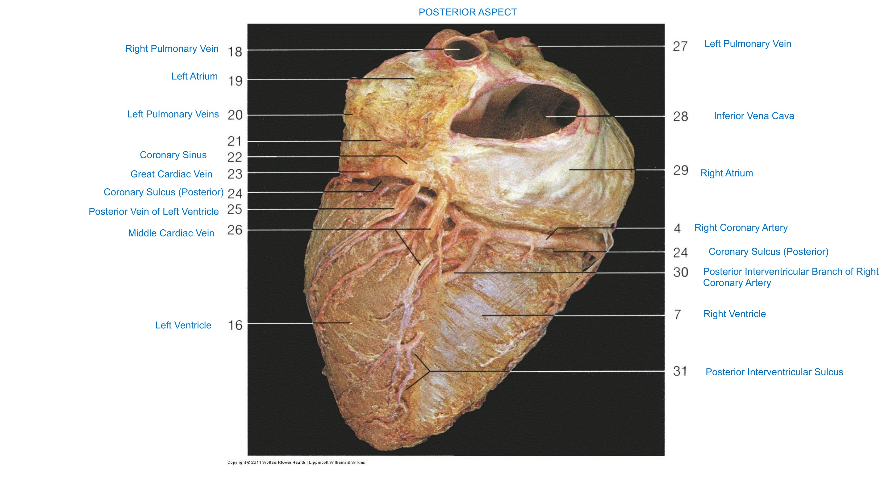 Heart, Venous Drainage (Posterior Aspect), fully labeled