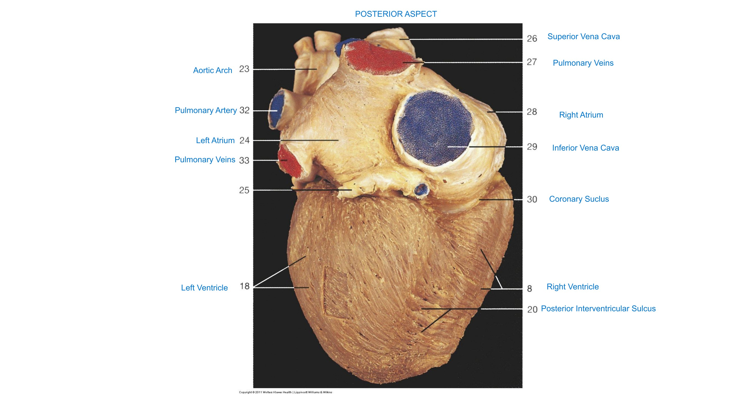 Heart, Isolated (Posterior Aspect), fully labeled