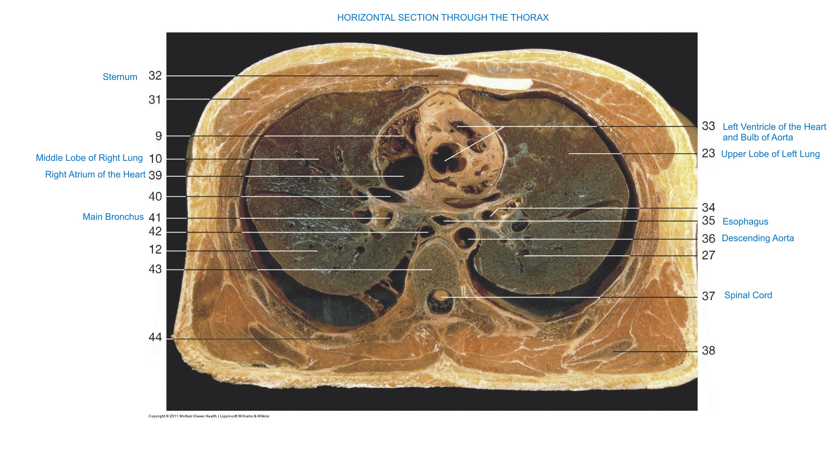 Horizontal Section Through the Thorax, fully labeled