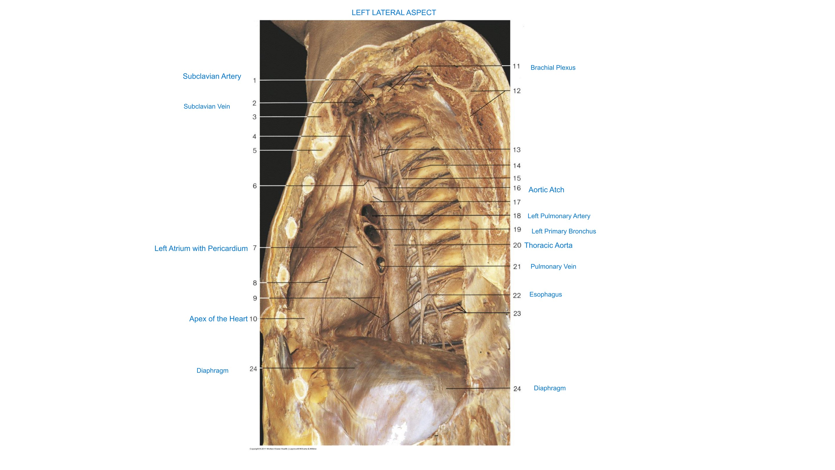 Heart & Lungs In Situ (Left Lateral Aspect), fully labeled