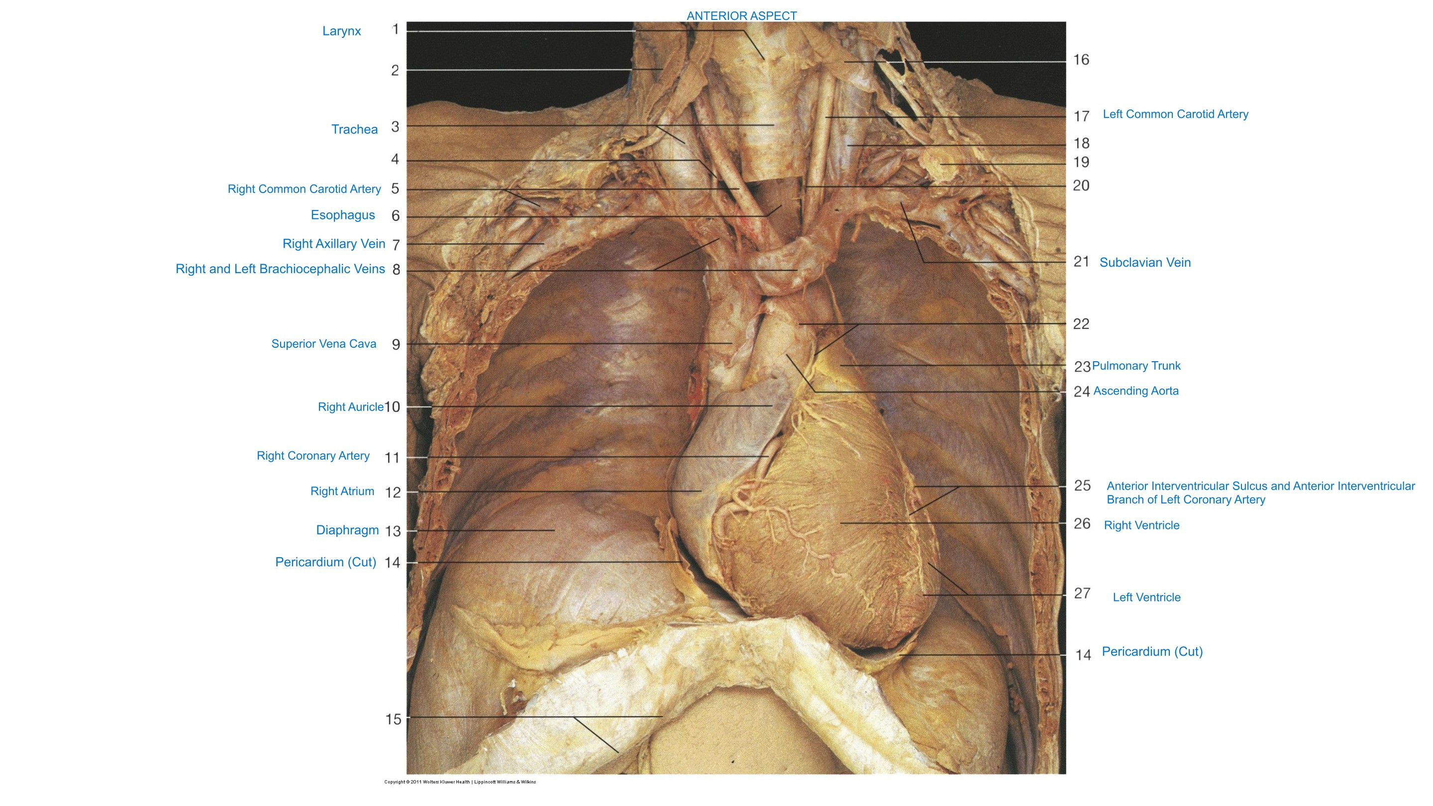 Neck & Thoracic Cavity, Heart (Anterior Aspect), fully labeled