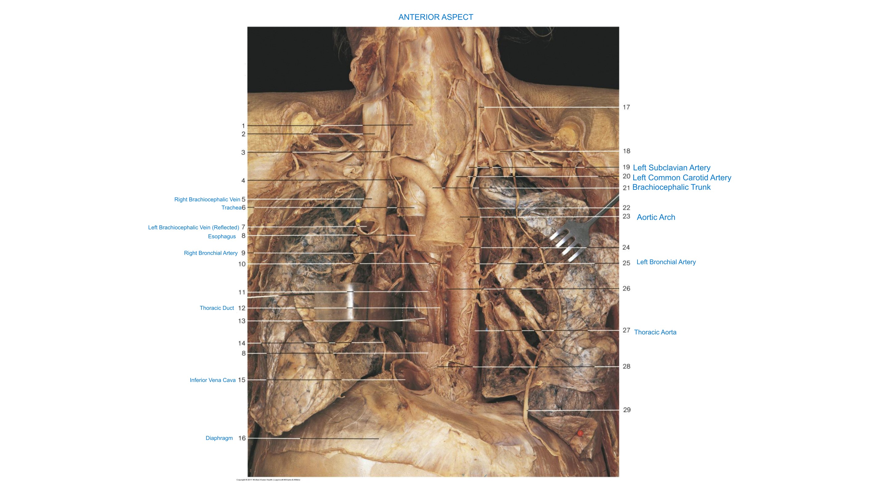Neck & Thoracic Cavity (Anterior Aspect, 3), fully labeled