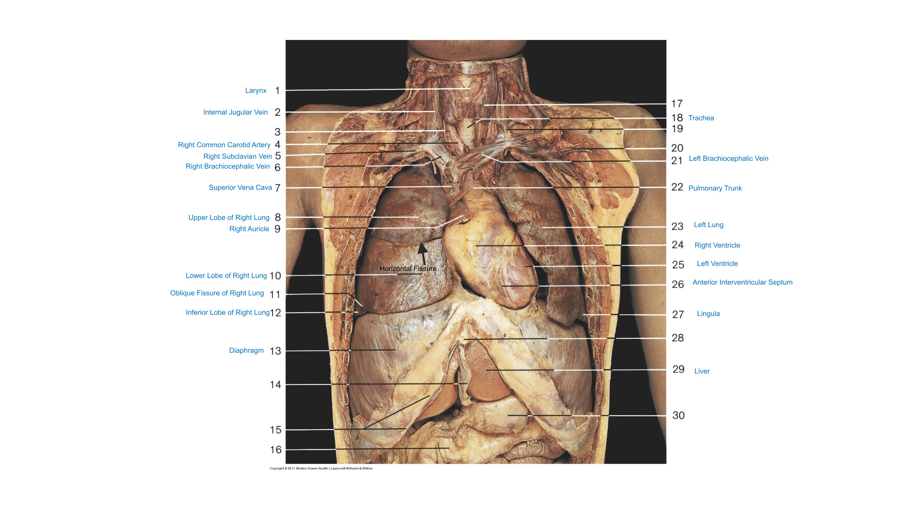 Neck & Thoracic Cavity (Anterior Aspect), fully labeled