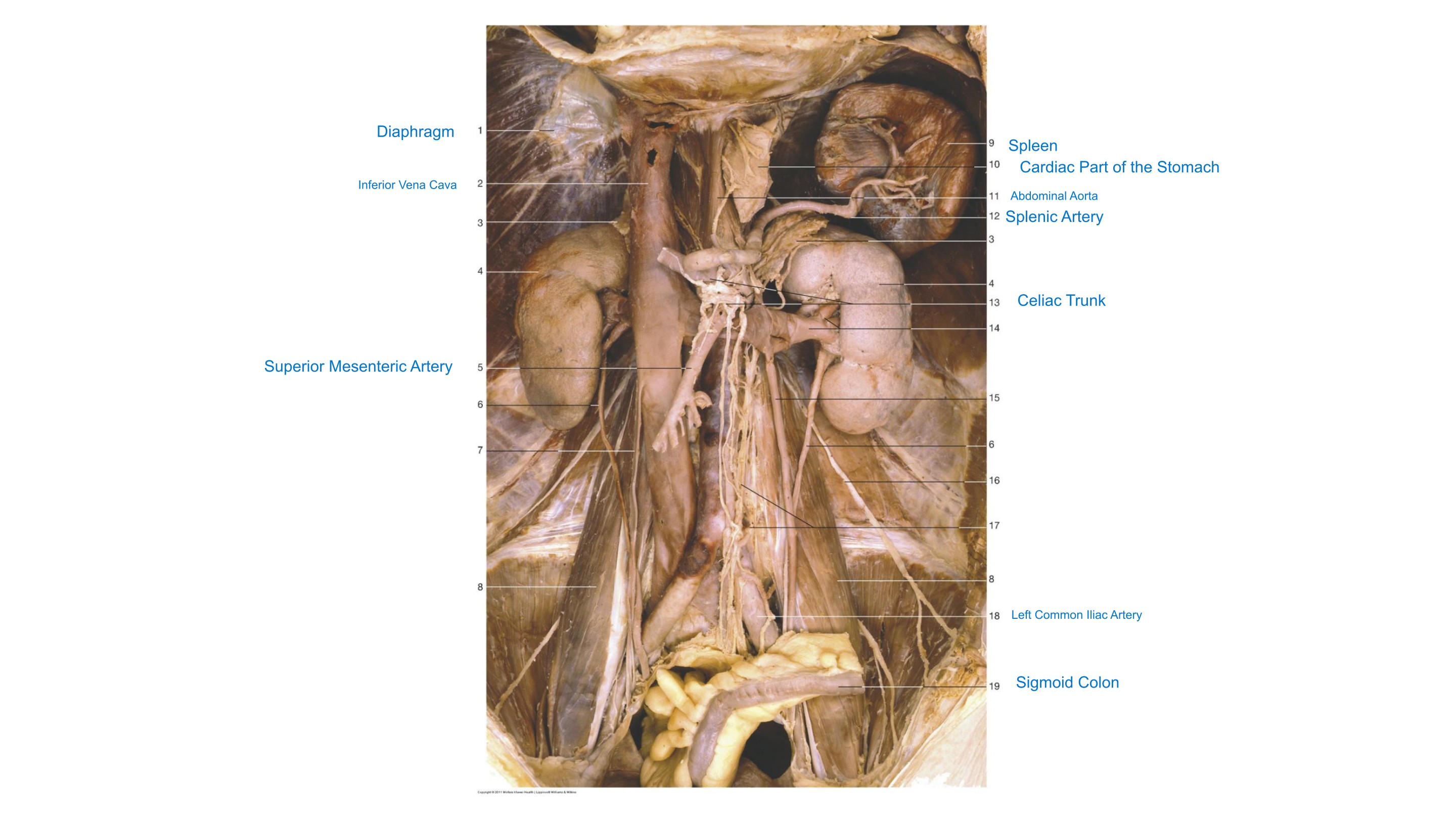 Posterior Abdominal Organs & Vessels (Anterior Aspect), fully labeled