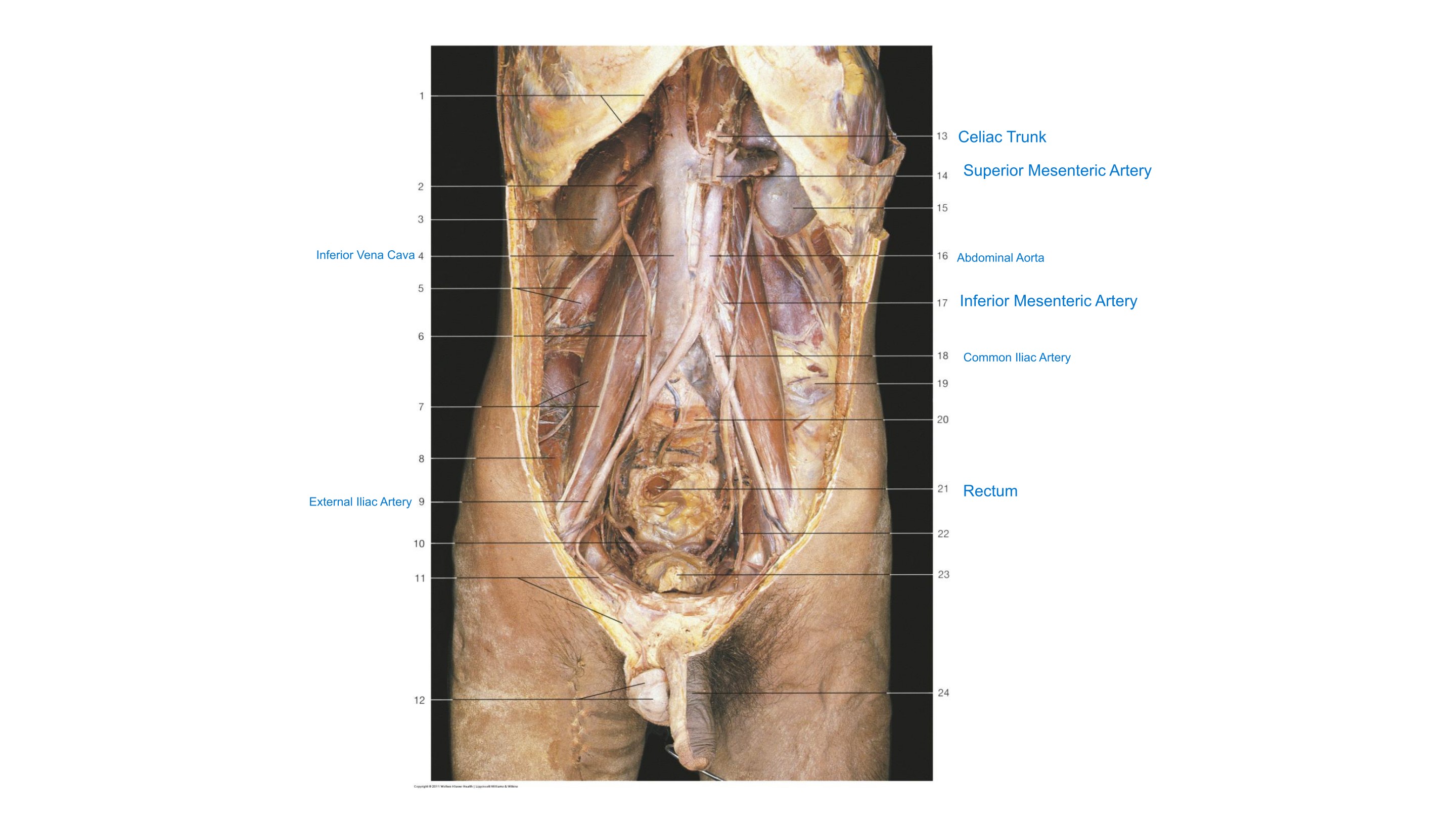 Posterior Abdominal Wall Vasculature (Anterior Aspect), fully labeled