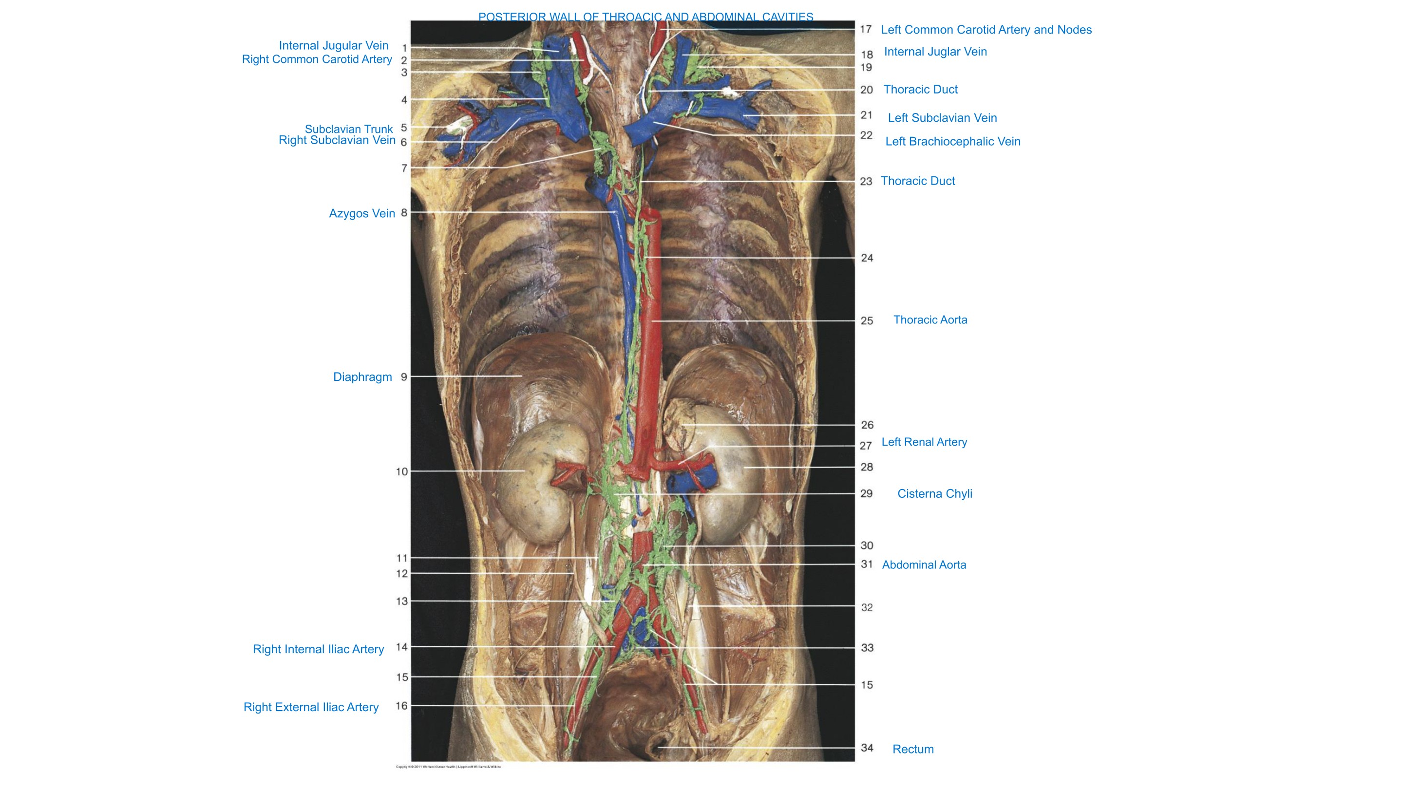 Posterior Wall of Thoracic & Abdominal Cavities (Lymphatics & Vessels), fully labeled