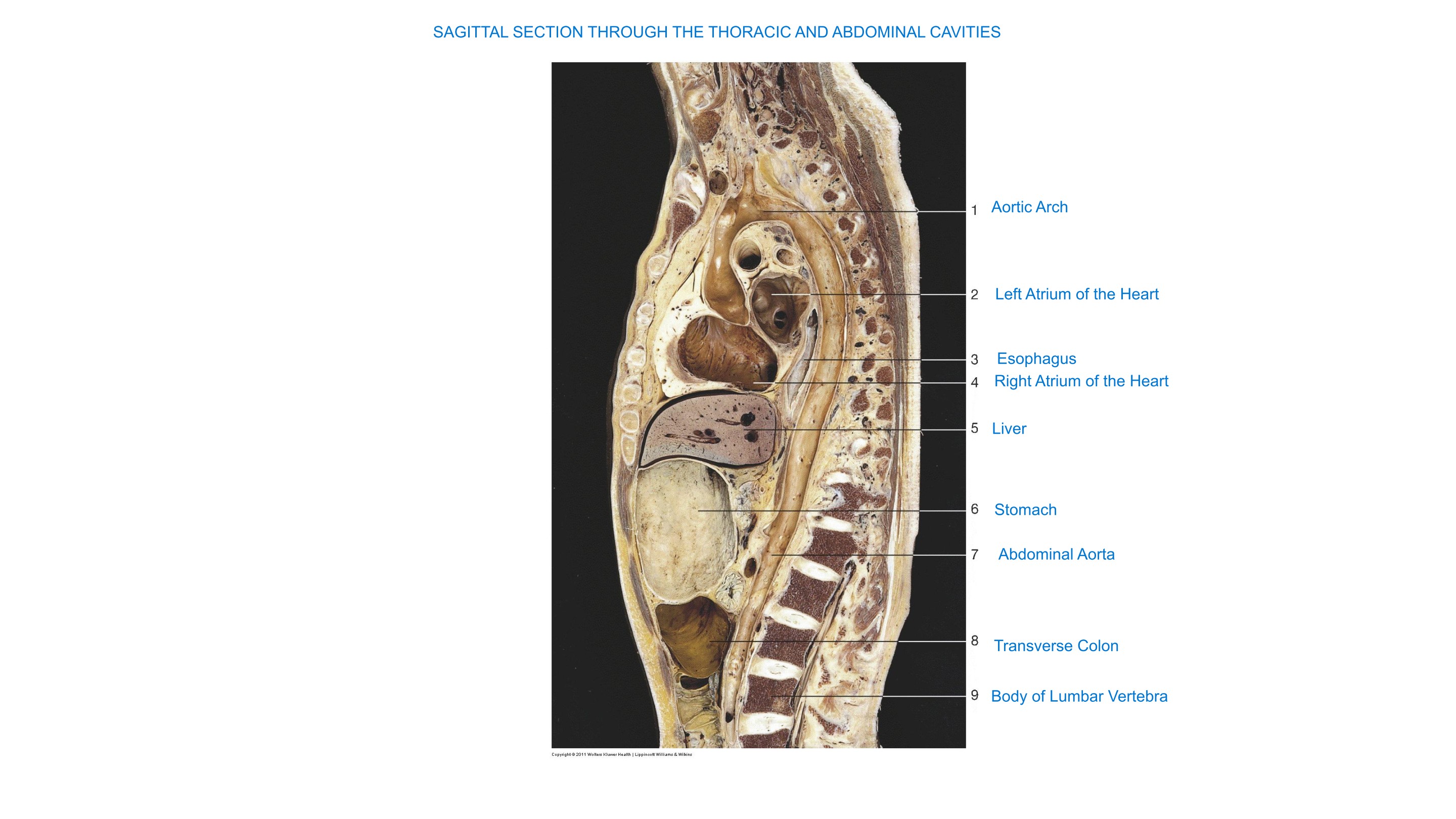 Sagittal Section Through the Thoracic and Abdominal Cavities, fully labeled