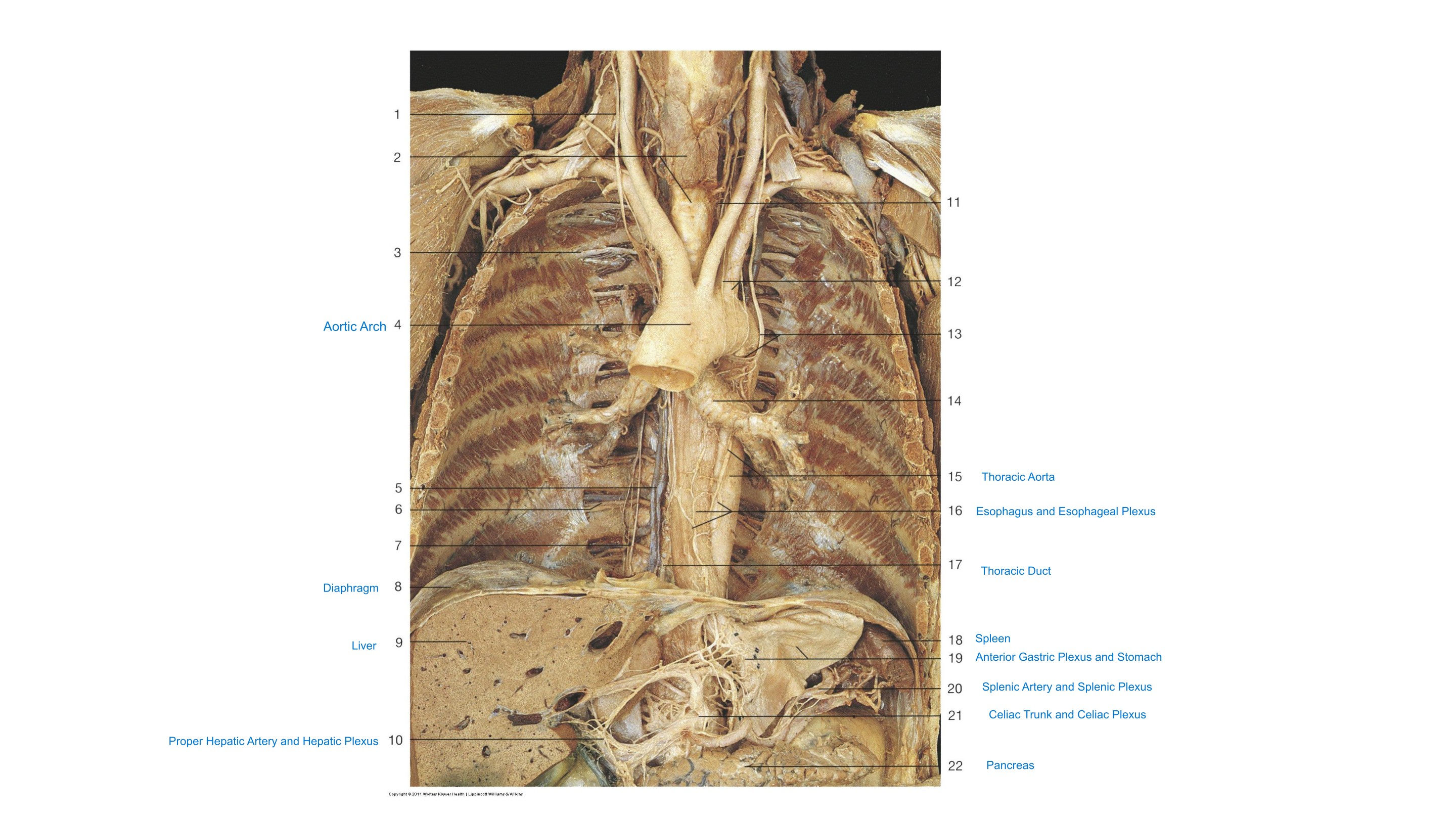 Thoracic & Abdominal Visceral Plexus (Overview), fully labeled