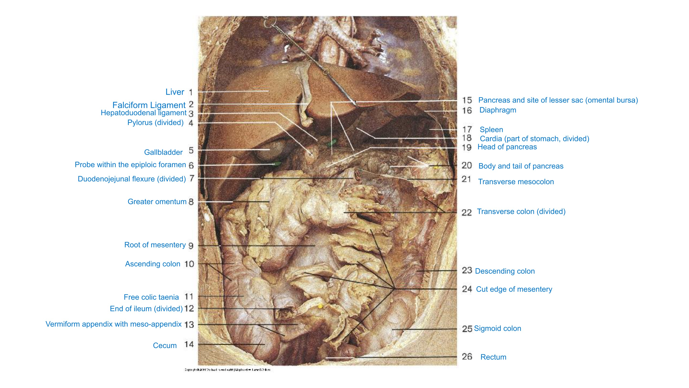Abdominal Cavity Overview (Peritoneal Reflections), fully labeled