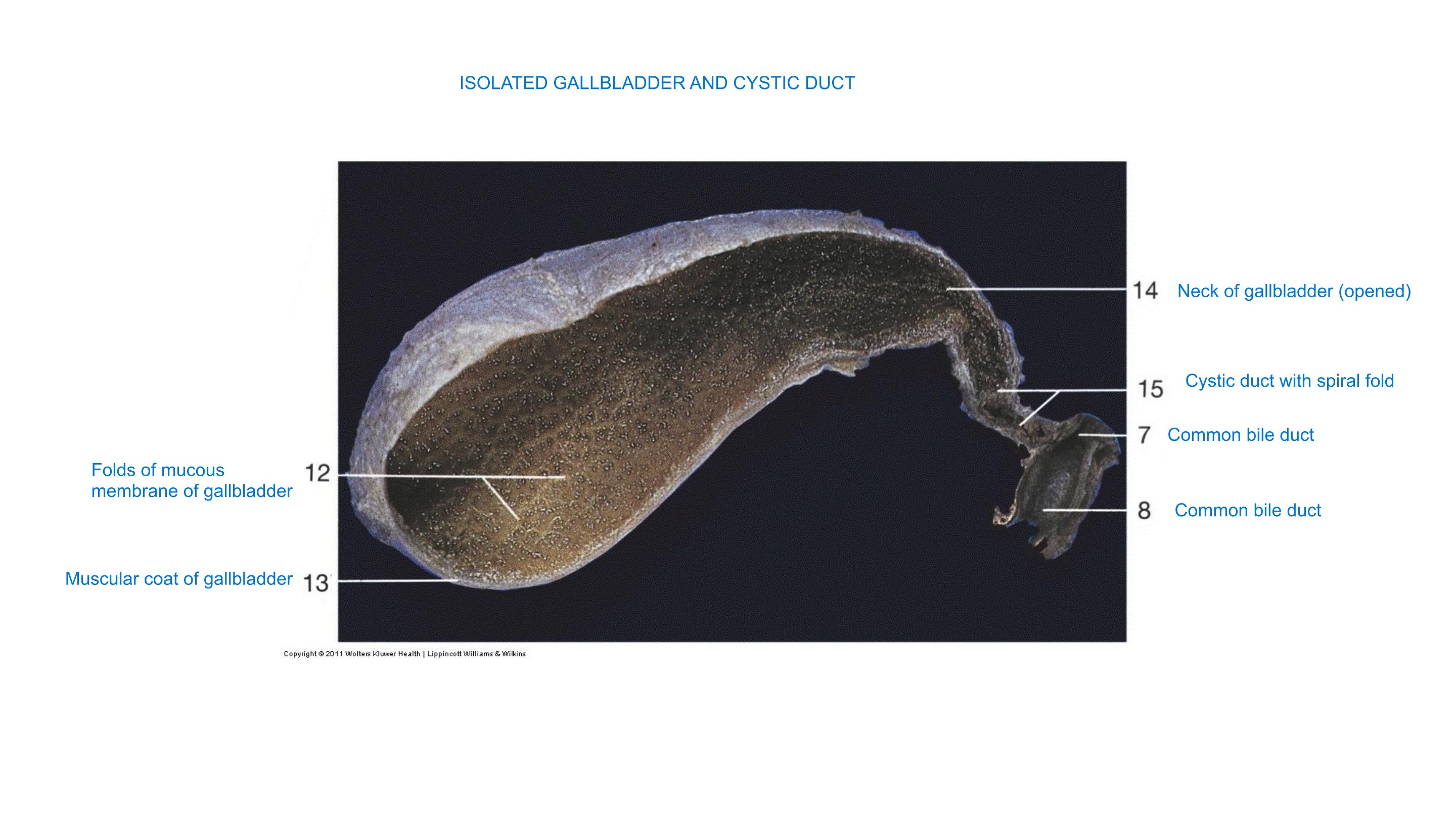 Isolated Gallbladder and Cystic Duct, fully labeled