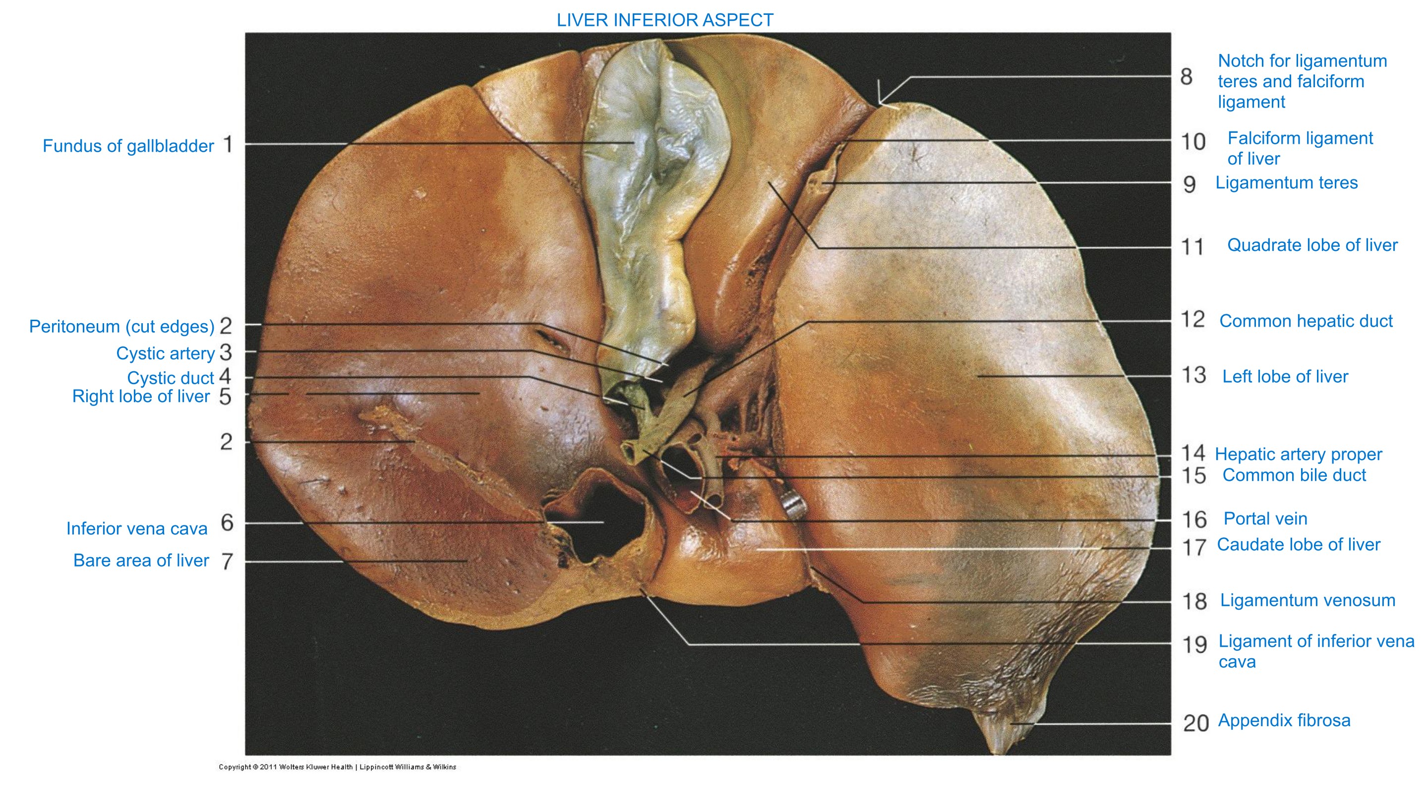 Liver — Inferior Aspect, fully labeled