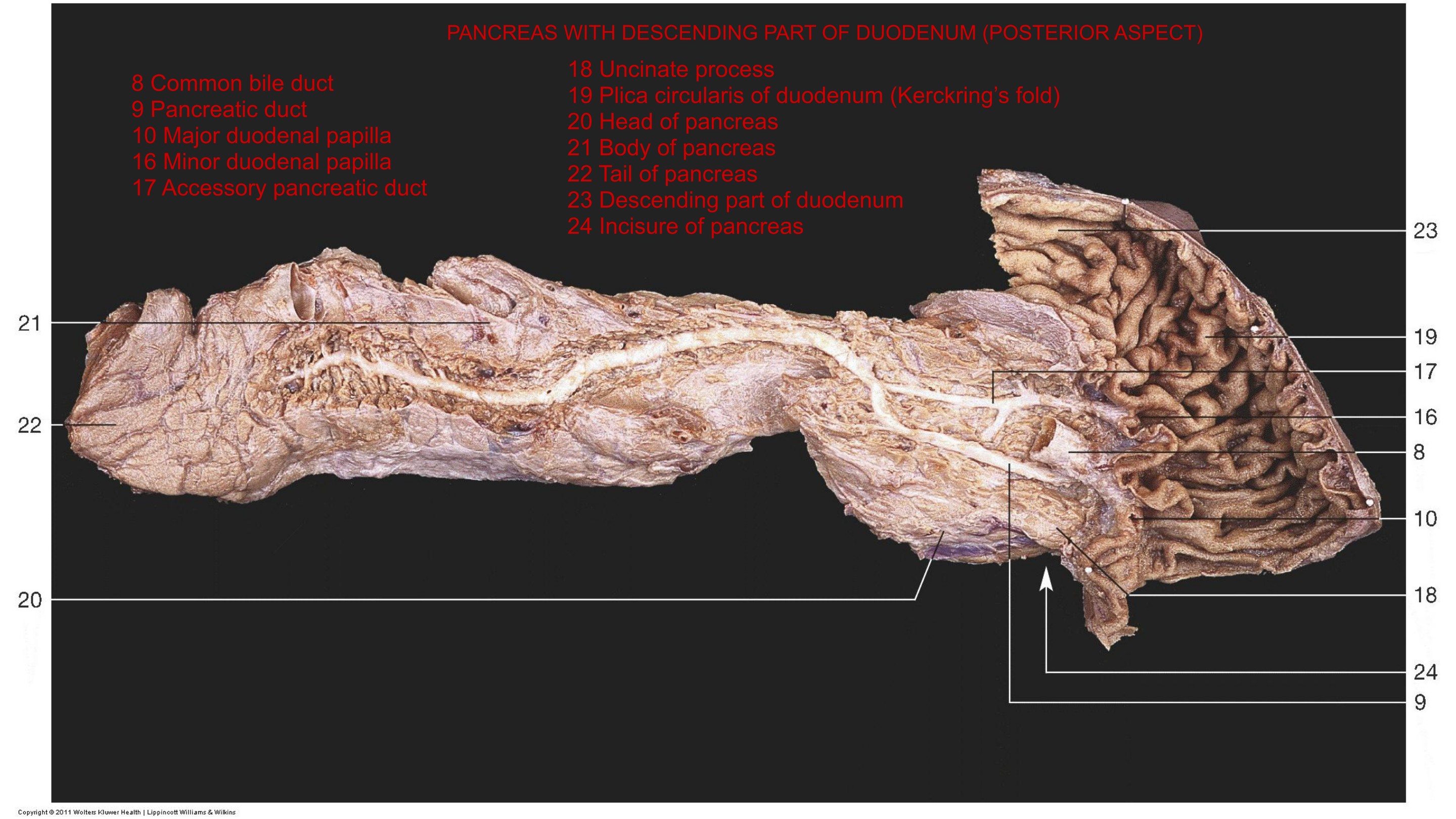 Pancreas with Descending Part of Duodenum (Posterior Aspect), fully labeled