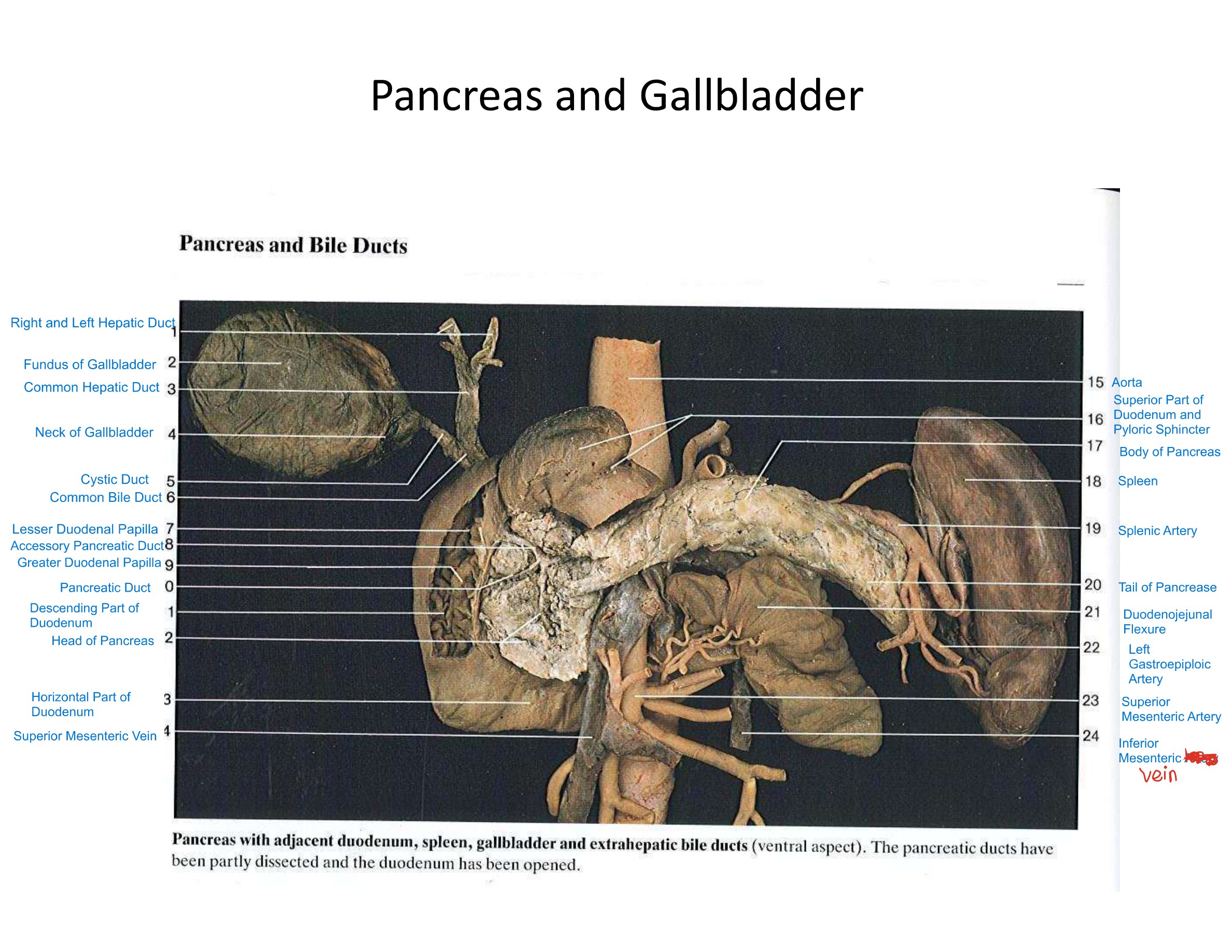 Pancreas and Gallbladder, fully labeled