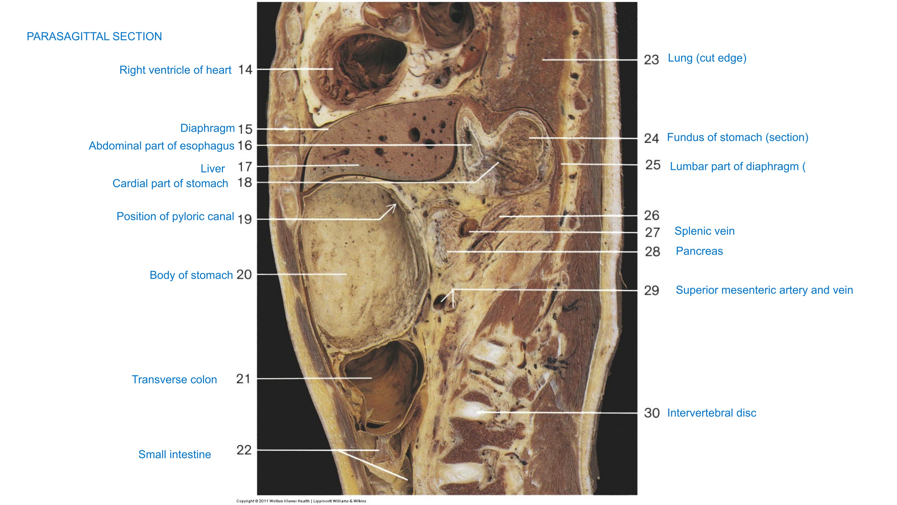 Parasagittal Section, fully labeled
