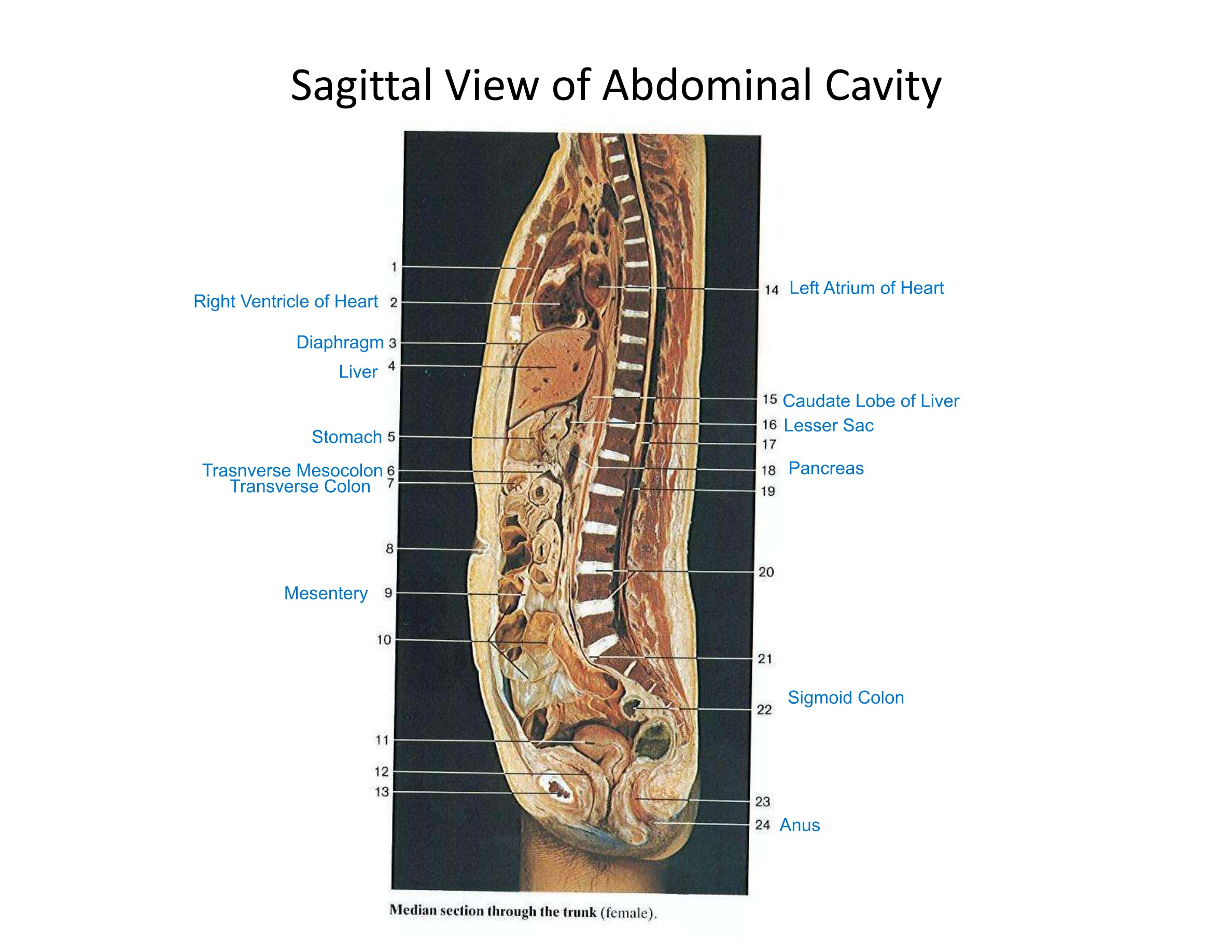 Sagittal View of Abdominal Cavity, fully labeled