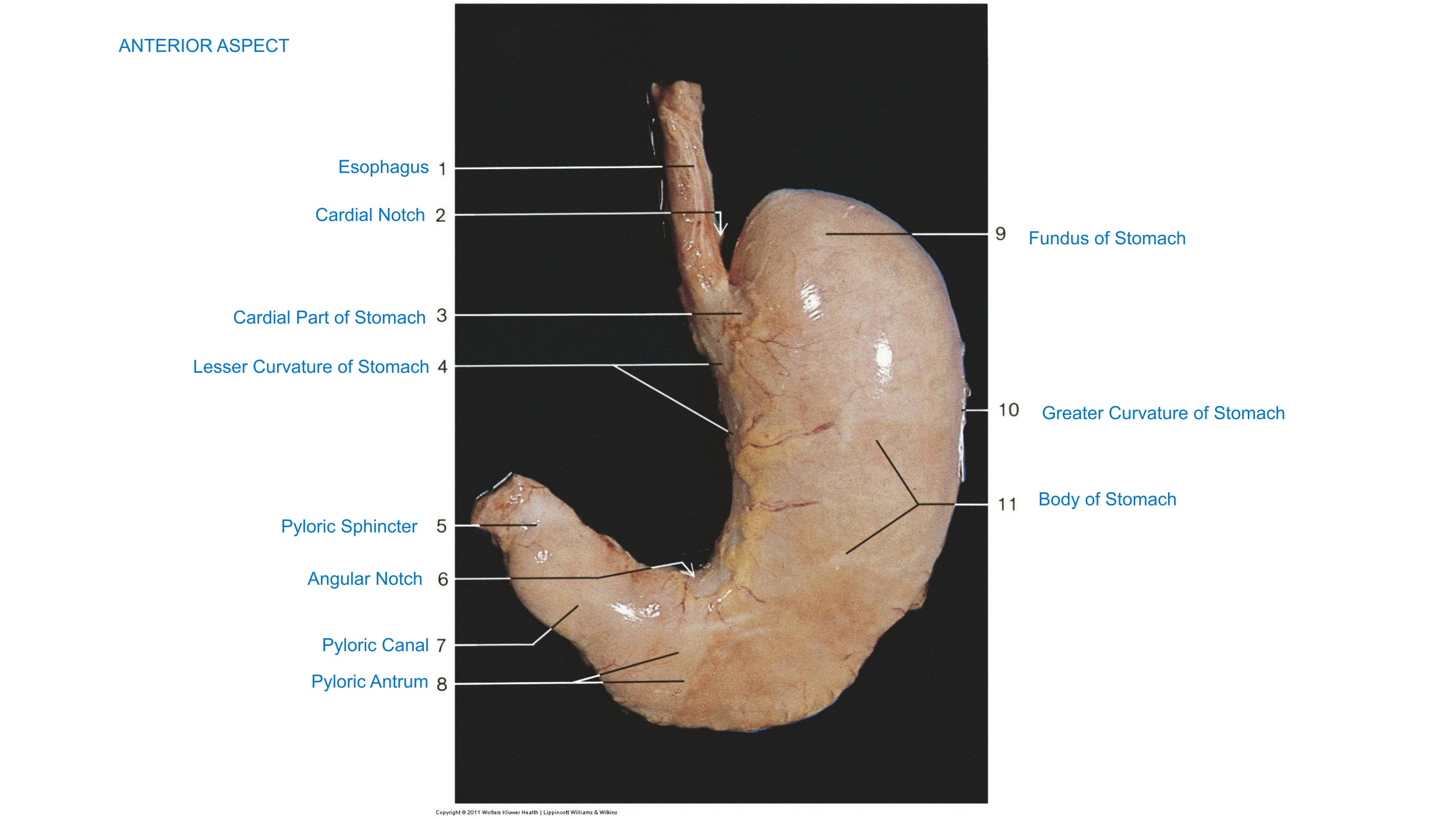 Stomach — Anterior Aspect, fully labeled