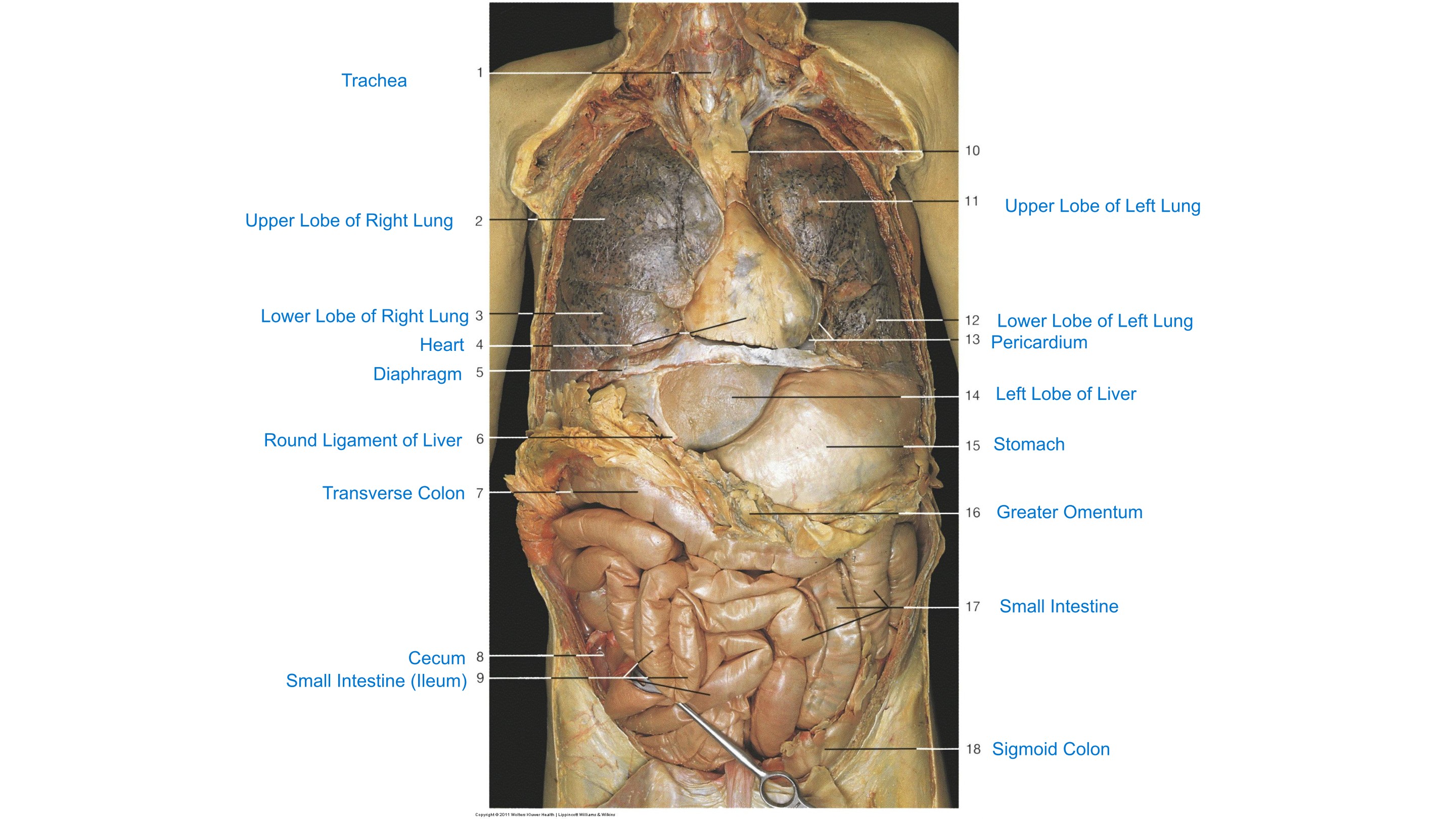 Thoracoabdominal Overview, fully labeled