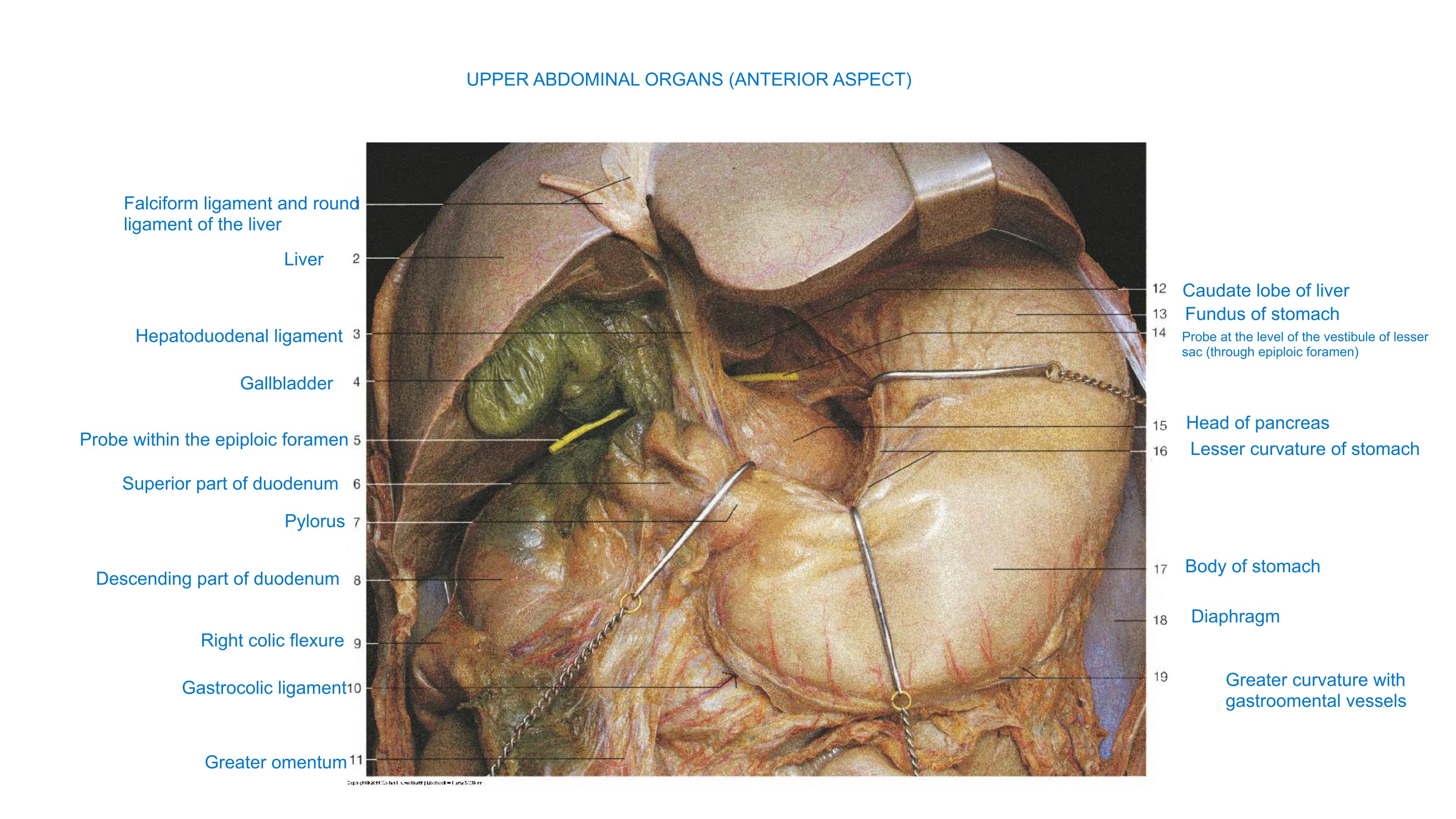Upper Abdominal Organs (Anterior Aspect) II, fully labeled