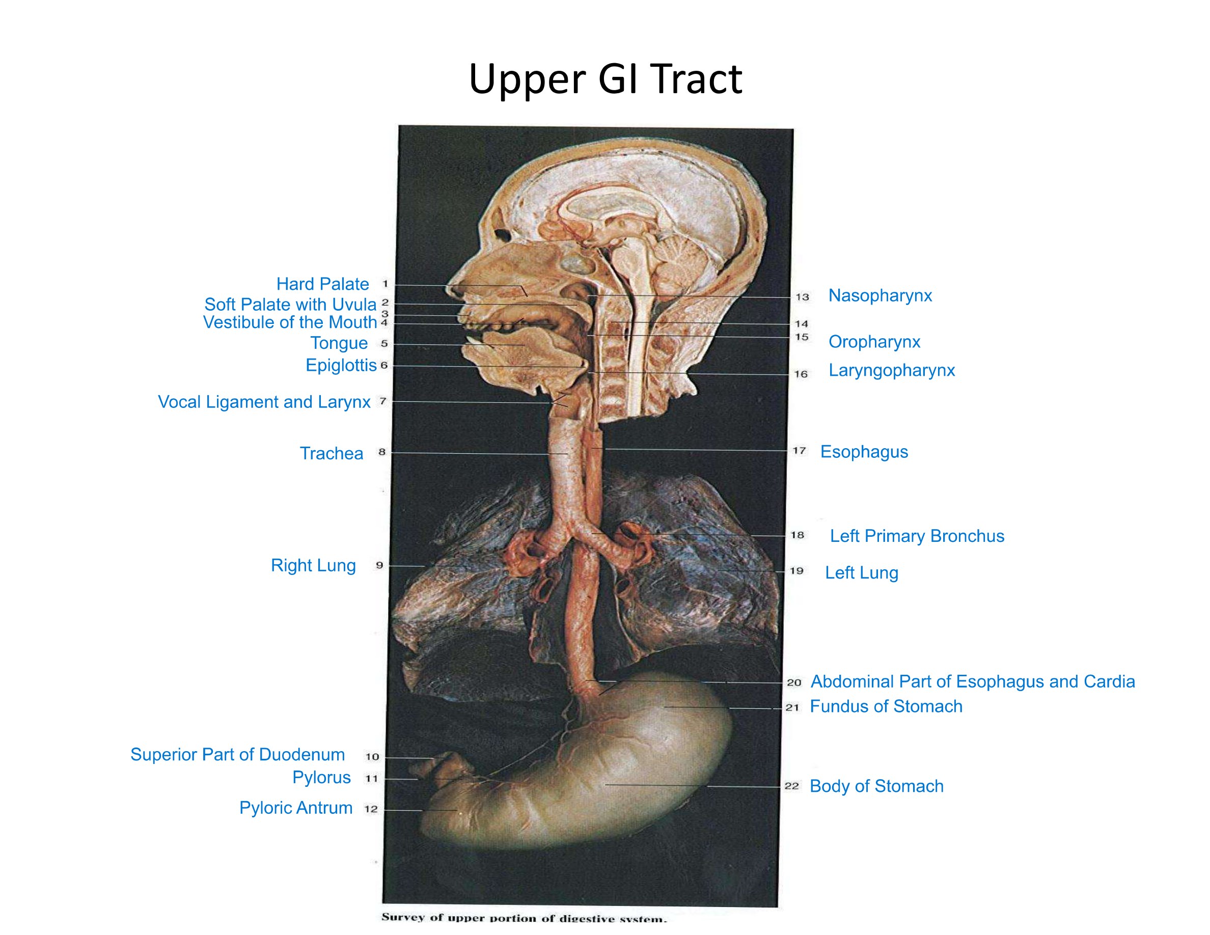 Upper GI Tract, fully labeled