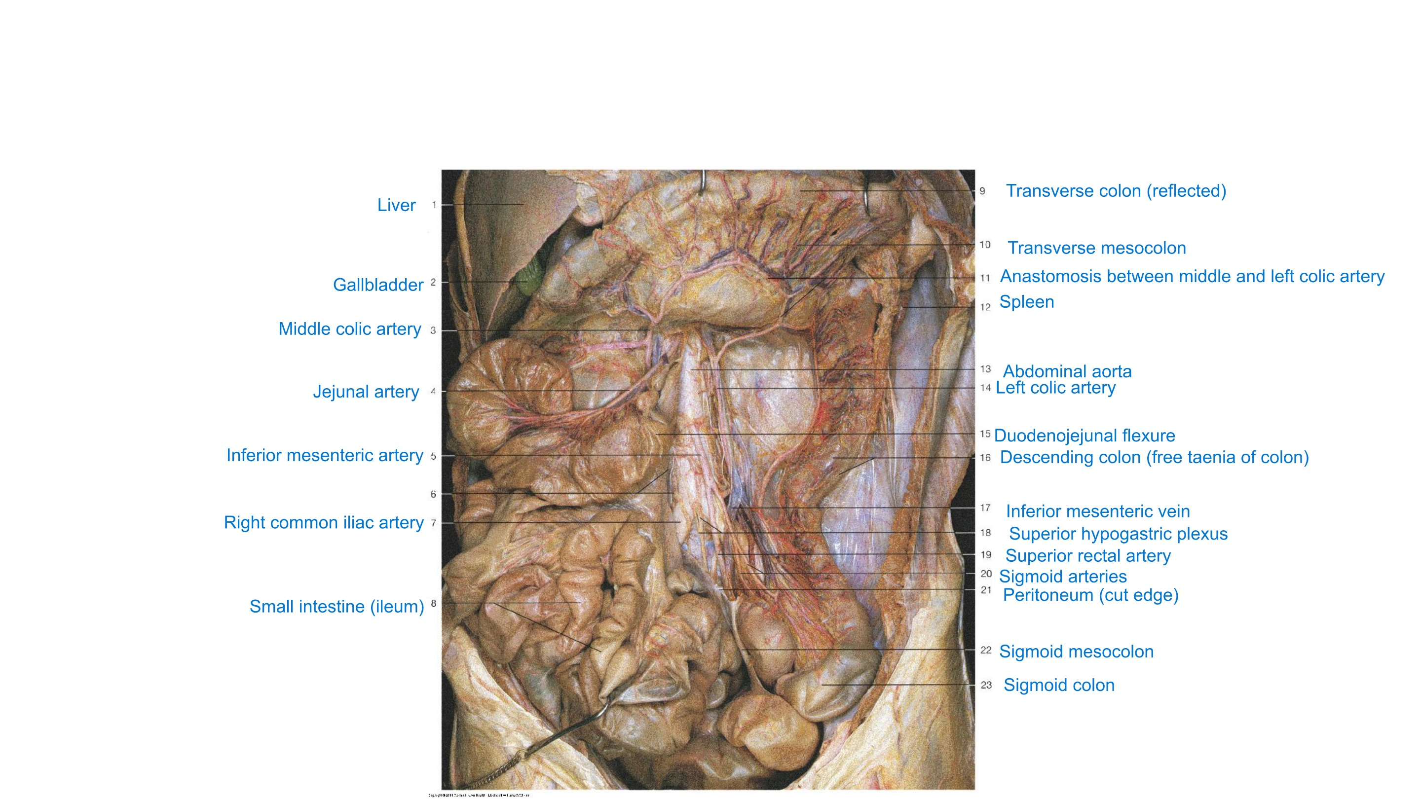 Vessels of Colon and Rectum (Artistic Rendering), fully labeled