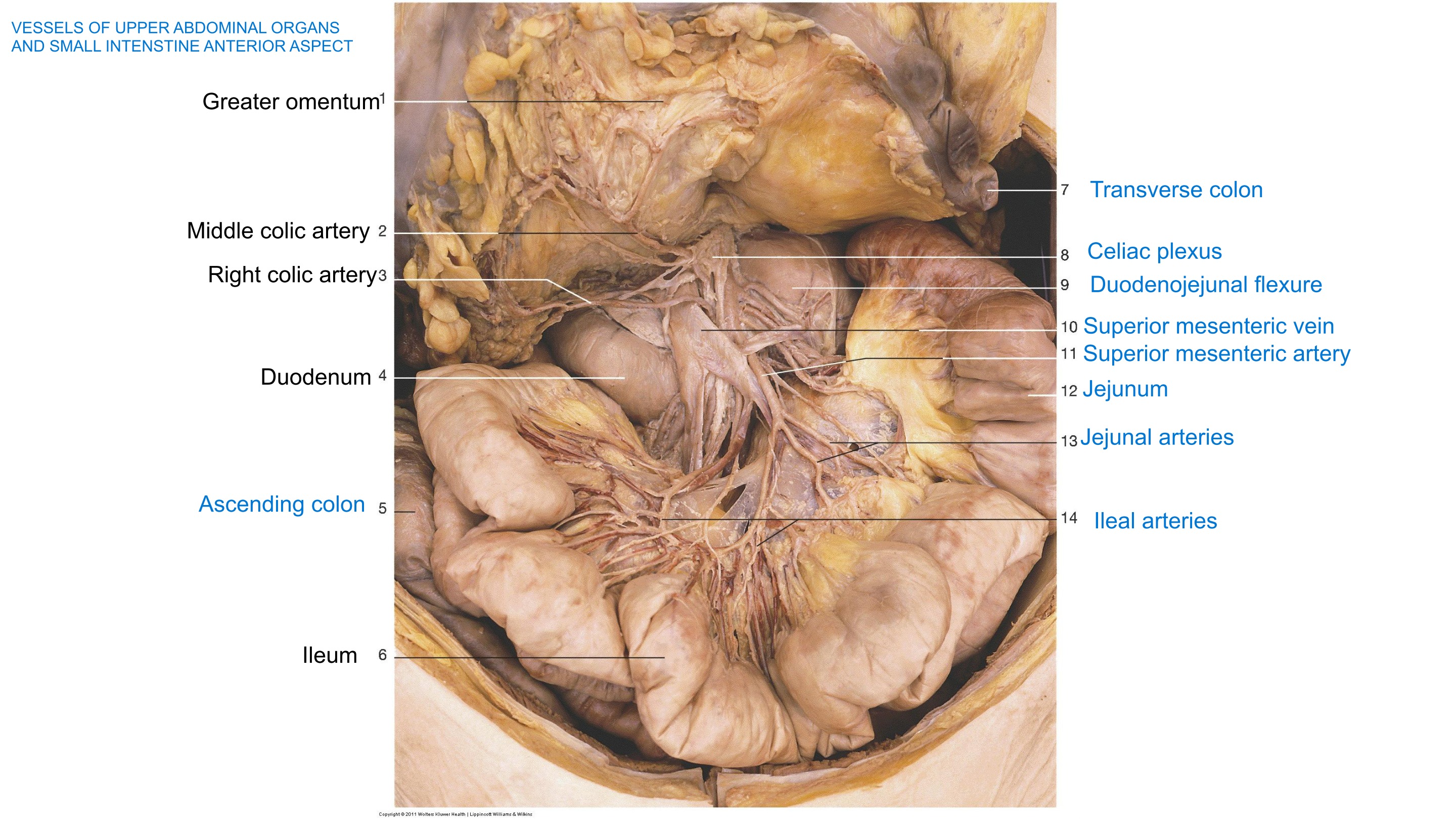 Vessels of Upper Abdominal Organs & Small Intestine, fully labeled