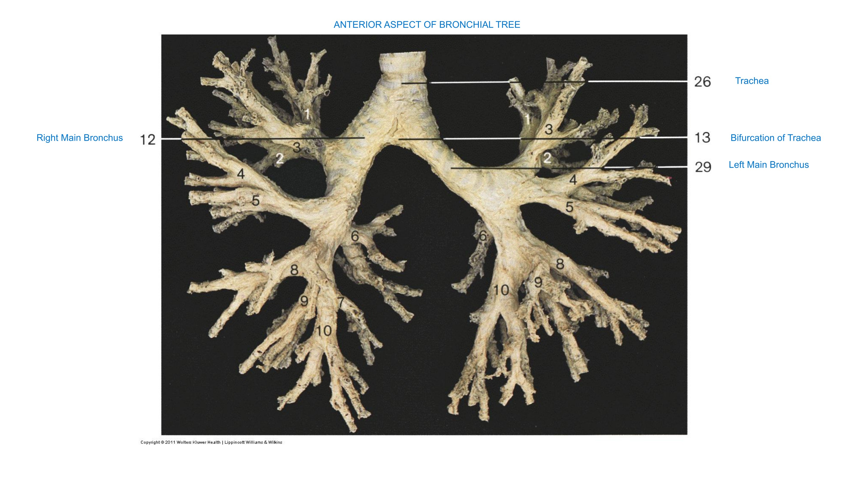 Bronchial Tree (Anterior Aspect), fully labeled