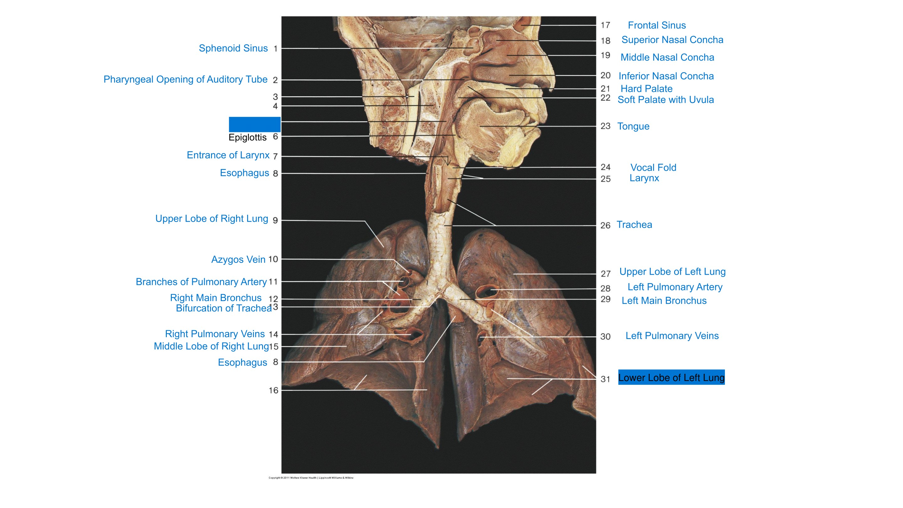 Head, Neck & Lower Respiratory Tract Overview, fully labeled