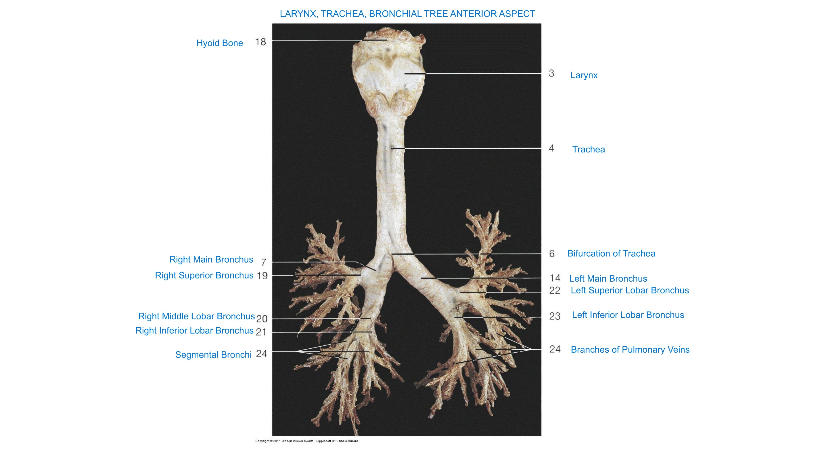 Larynx, Trachea & Bronchial Tree (Anterior Aspect), fully labeled