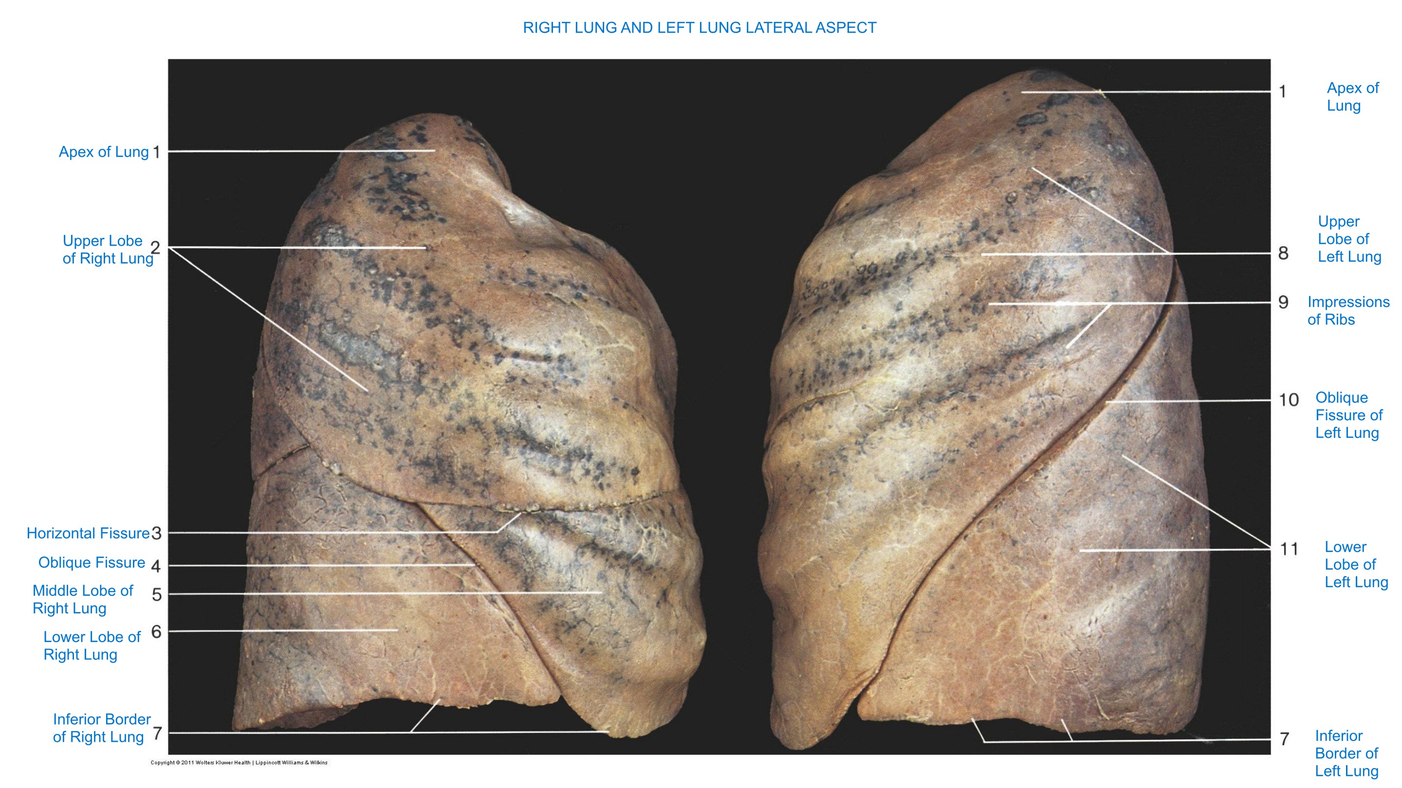 Right Lung and Left Lung (Lateral Aspect), fully labeled