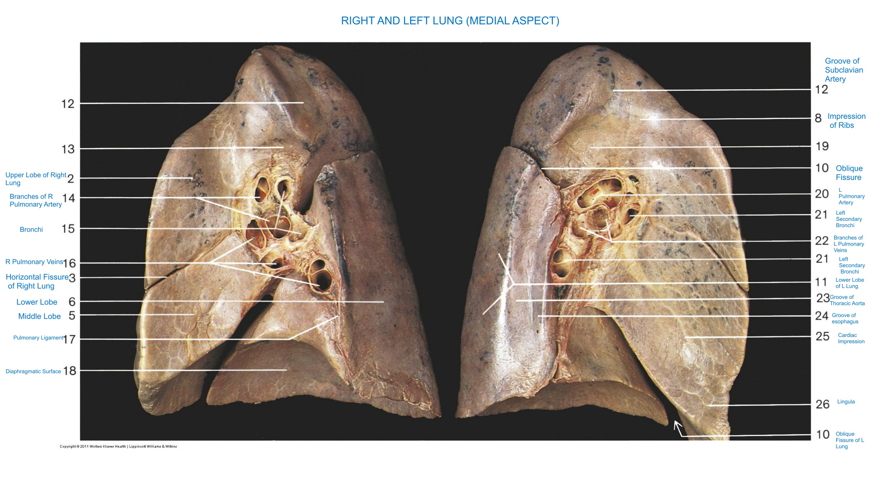 Right and Left Lung (Medial Aspect), fully labeled