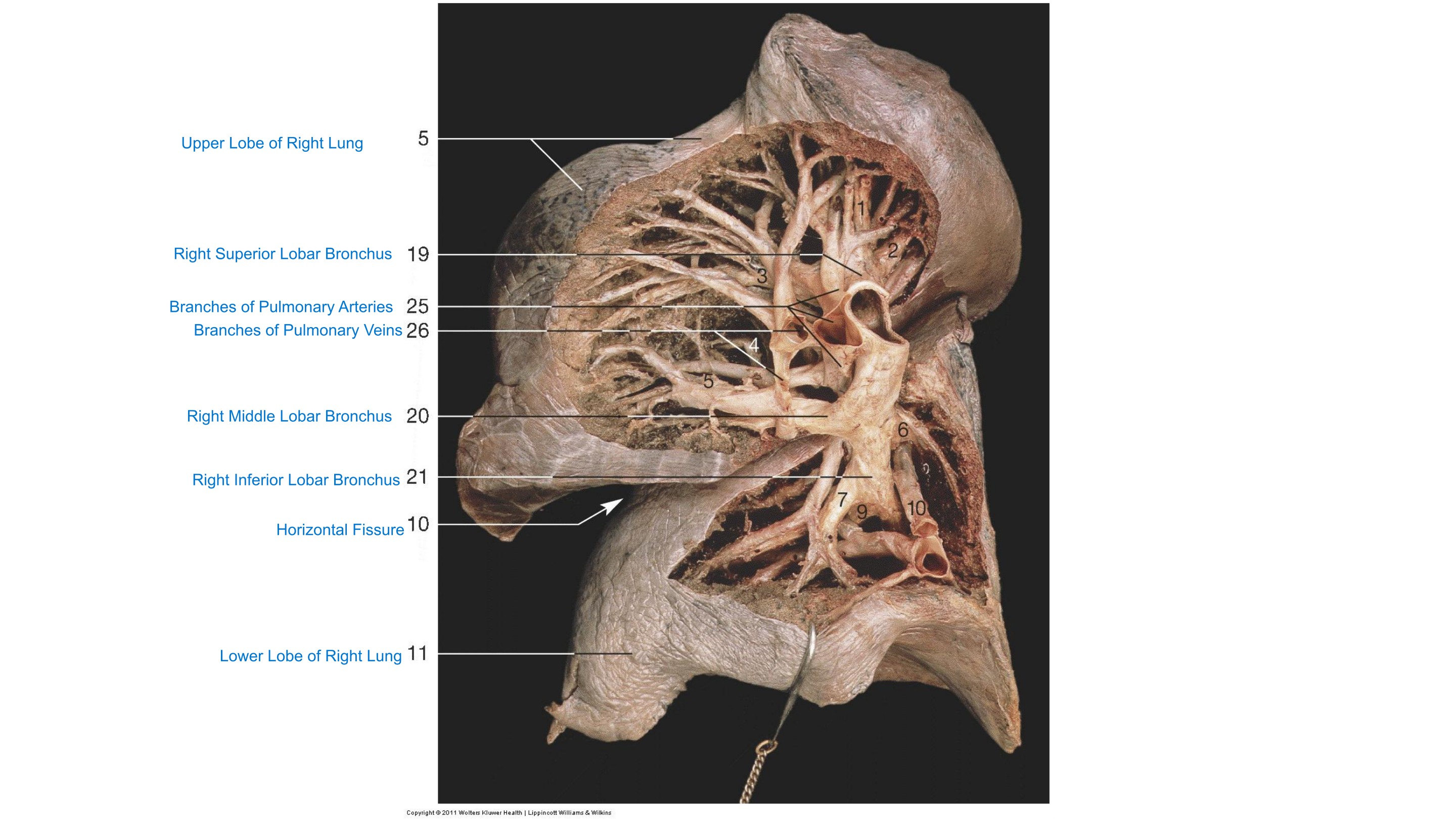 Right Lung Dissection (Hilum), fully labeled